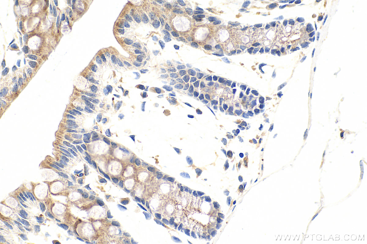 IHC staining of mouse colon using 11315-1-AP IHC staining of mouse colon using 11315-1-AP