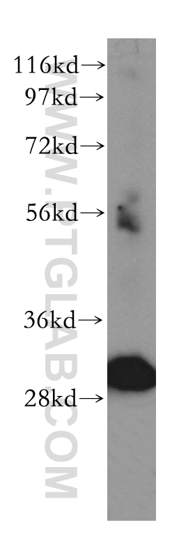 TOLLIP Polyclonal antibody