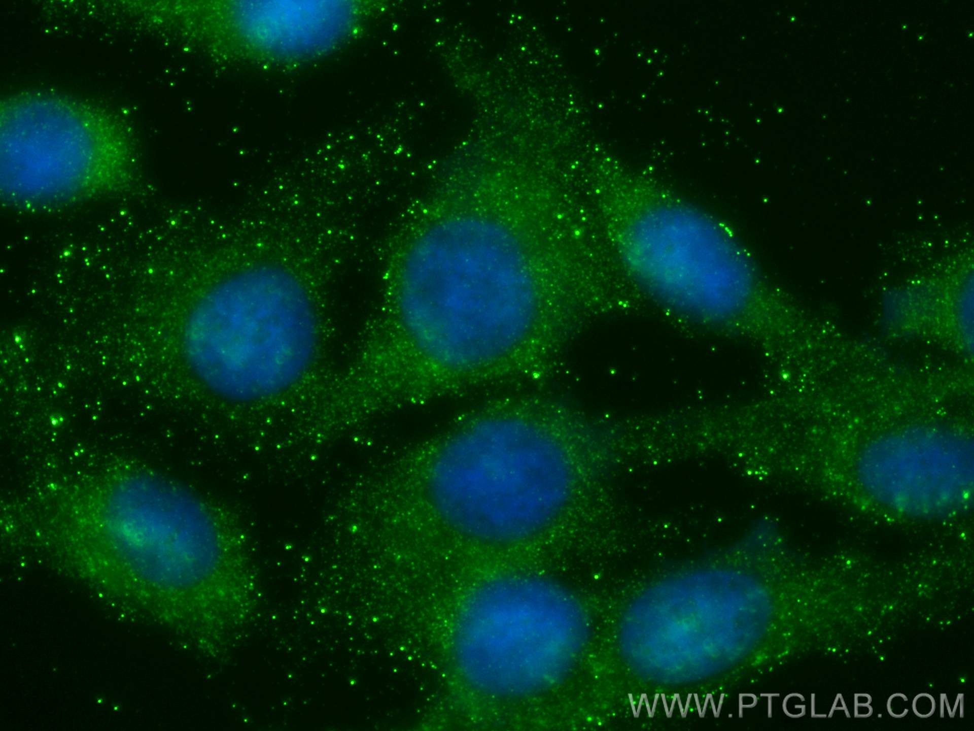 IF Staining of U2OS using 68170-1-Ig (same clone as 68170-1-PBS)