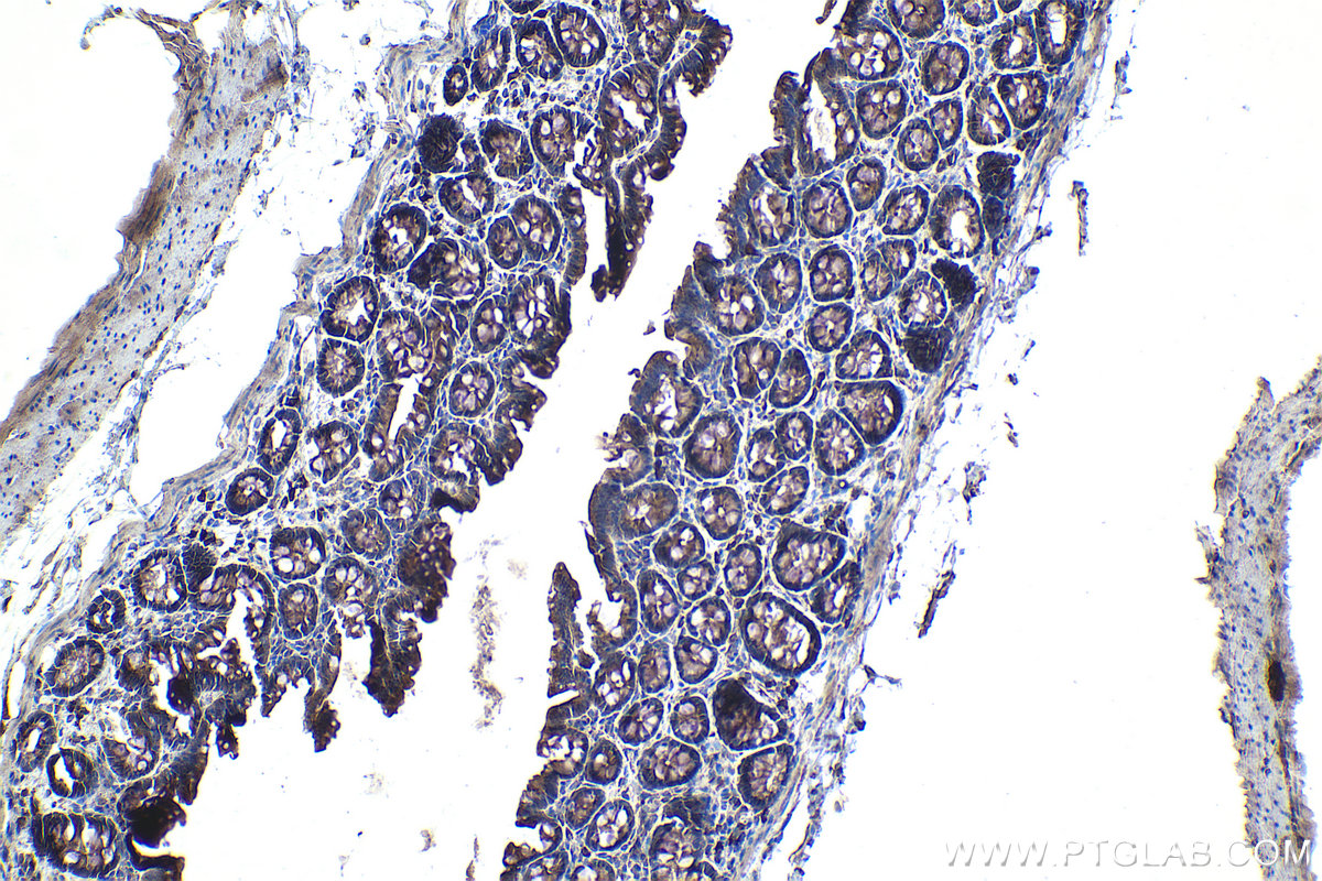 IHC staining of rat colon using 68170-1-Ig