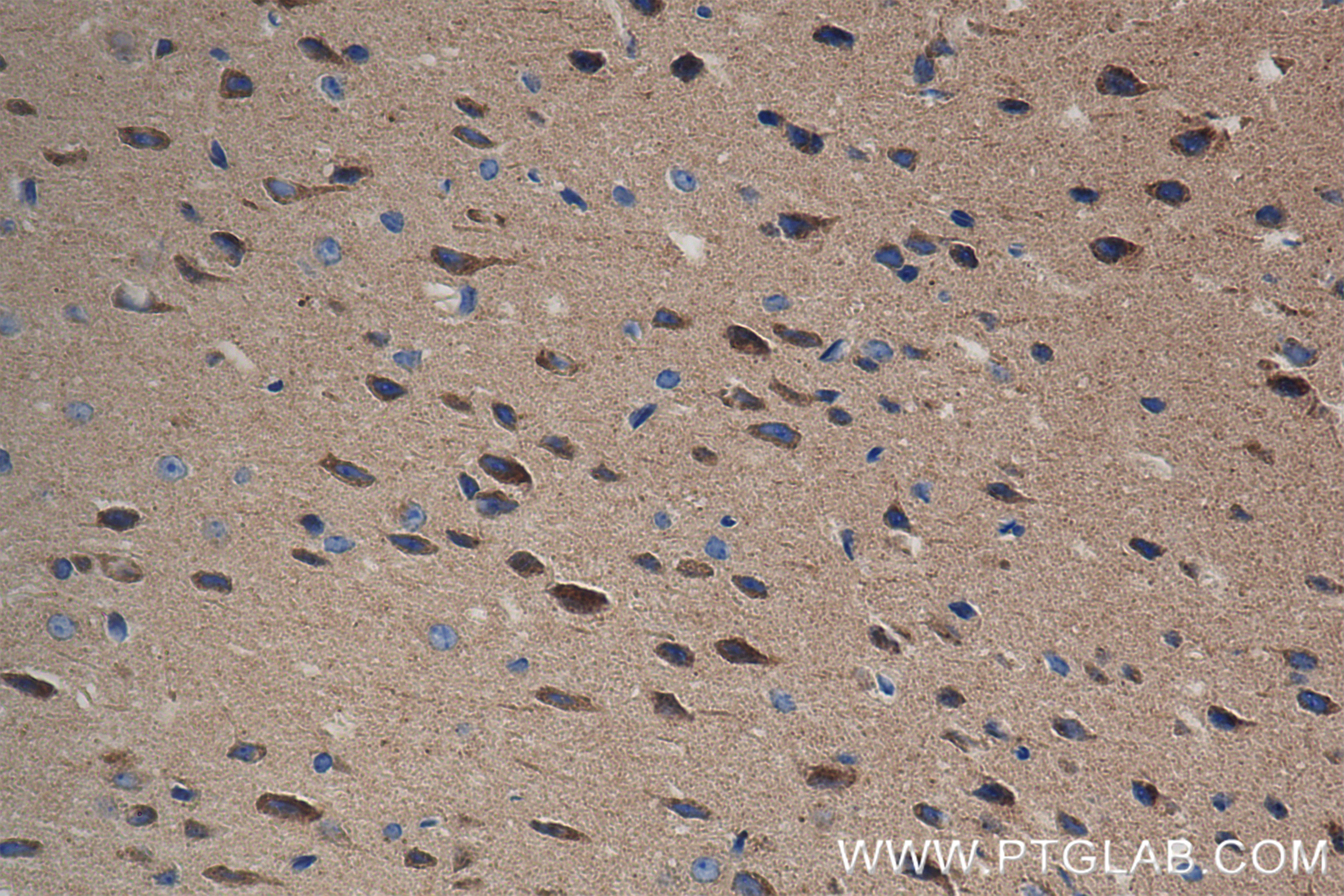IHC staining of mouse brain using 84711-5-RR (same clone as 84711-5-PBS)