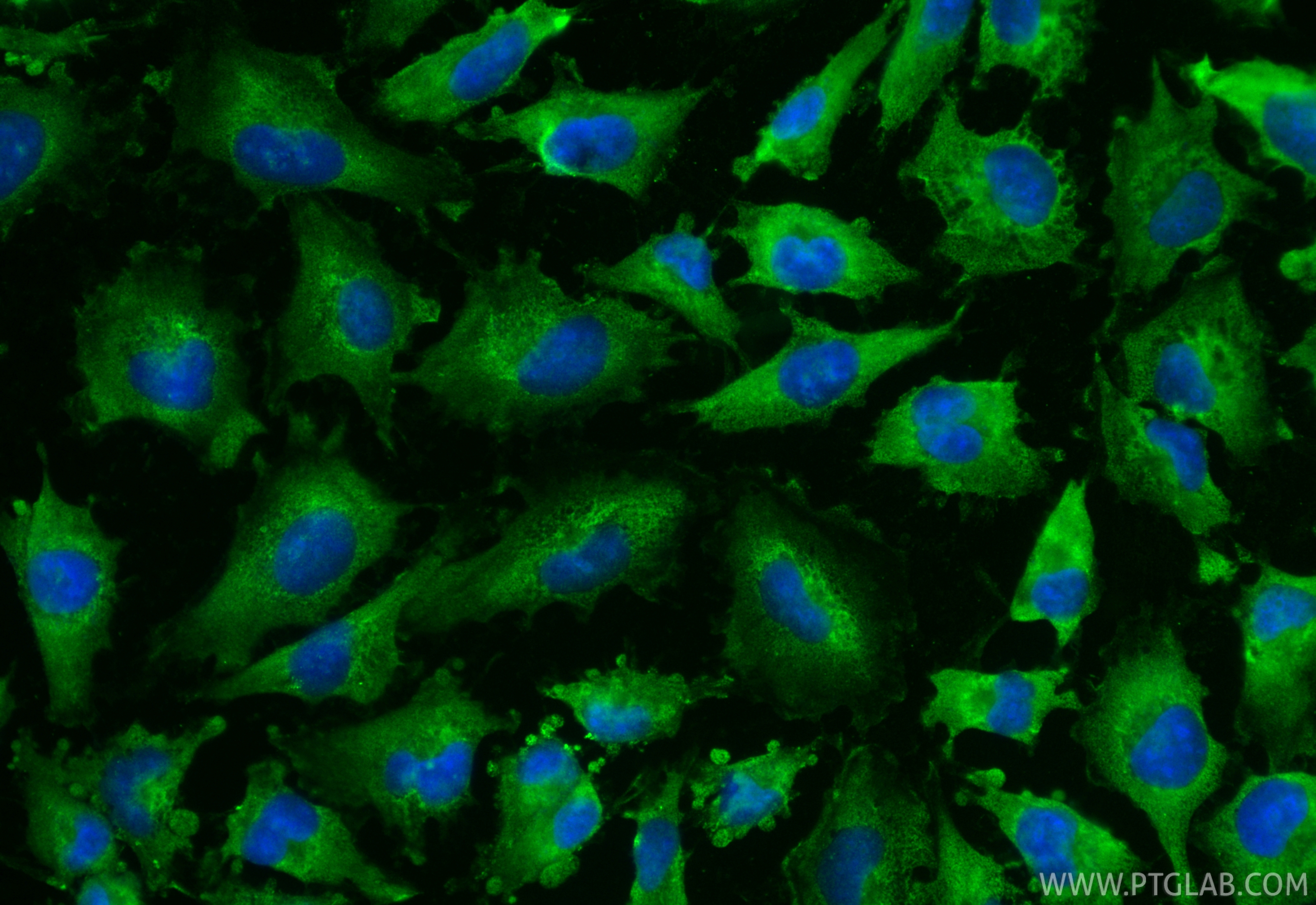 IF Staining of U-251 using CL488-68170 IF Staining of U-251 using CL488-68170