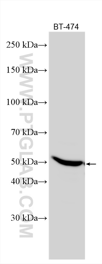 WB analysis using 51017-1-AP