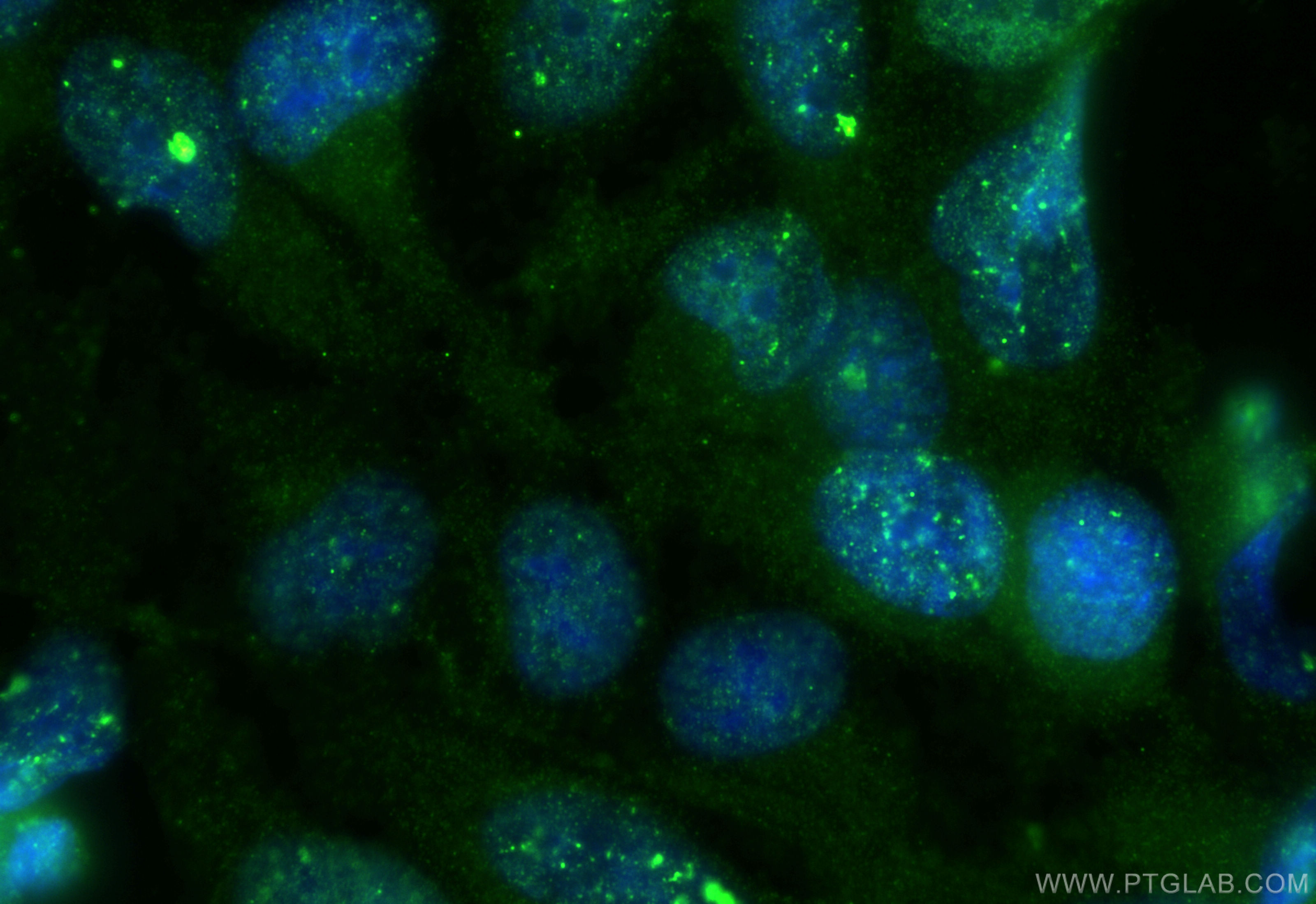 IF Staining of HeLa using 32179-1-AP