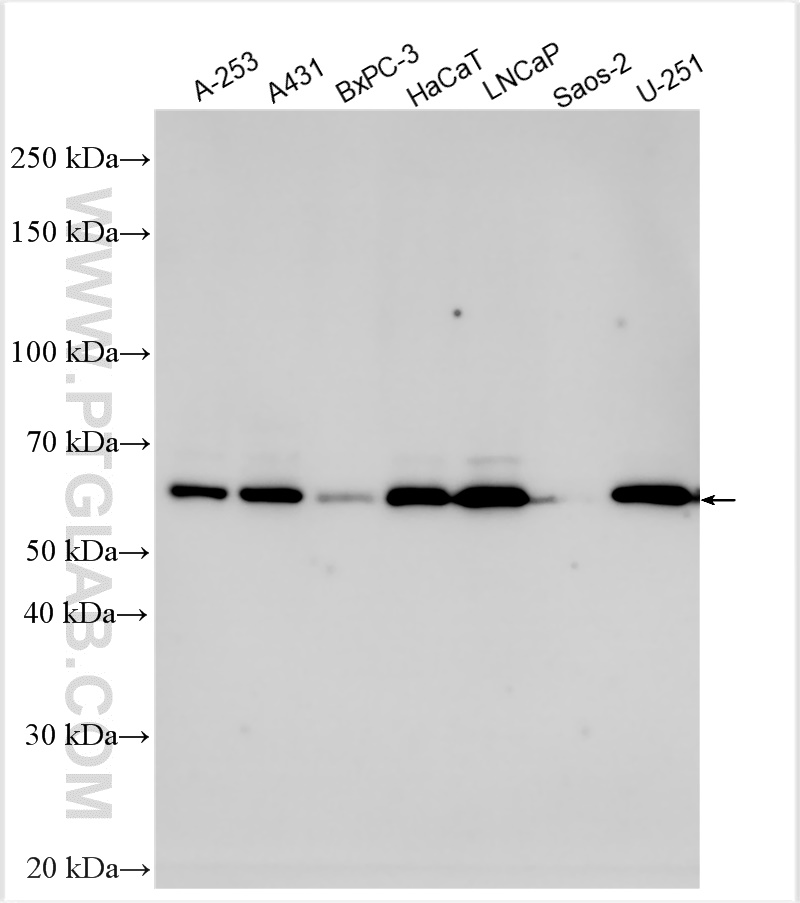 WB analysis using 32179-1-AP