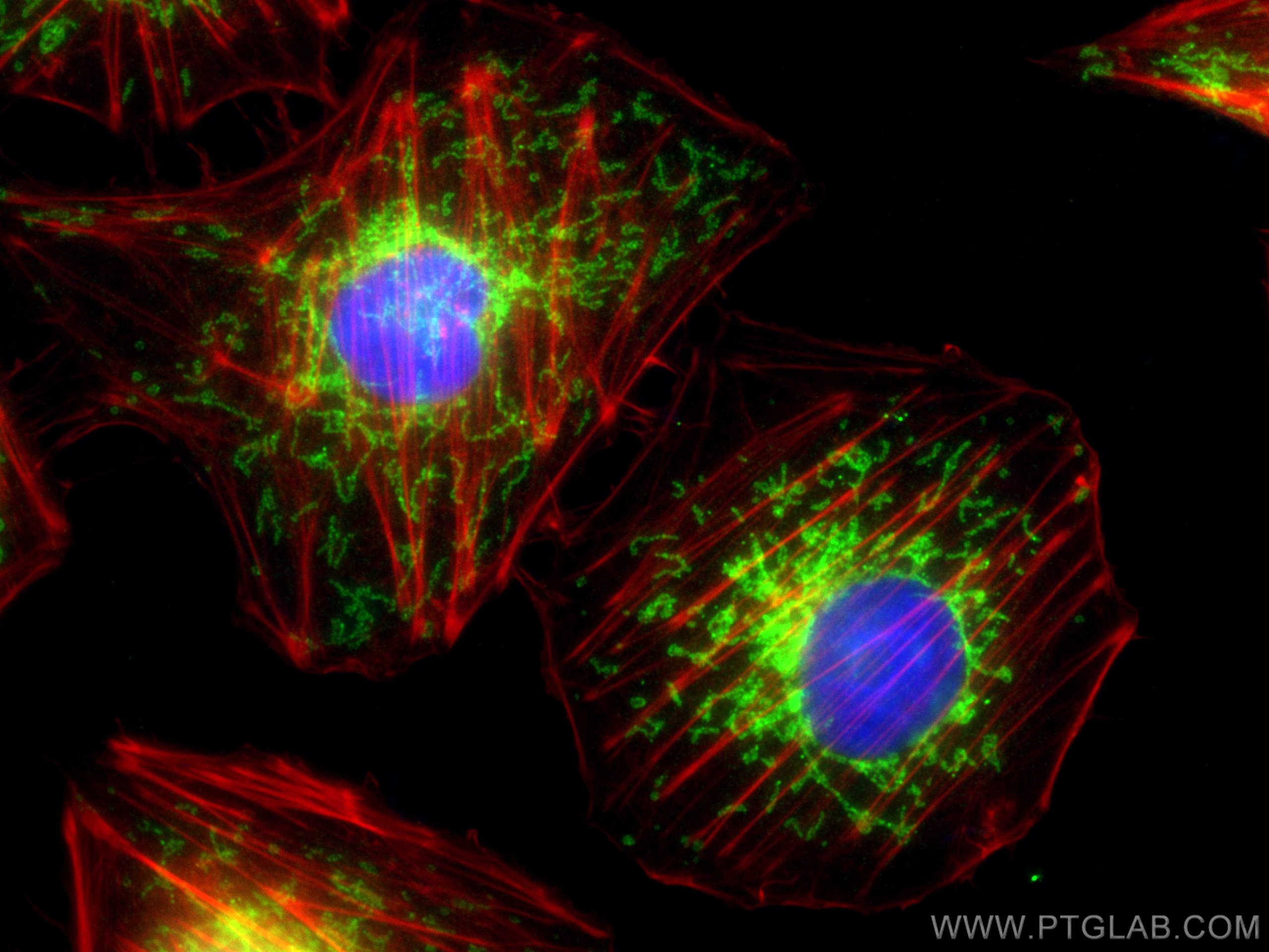 IF Staining of HUVEC using 11802-1-AP