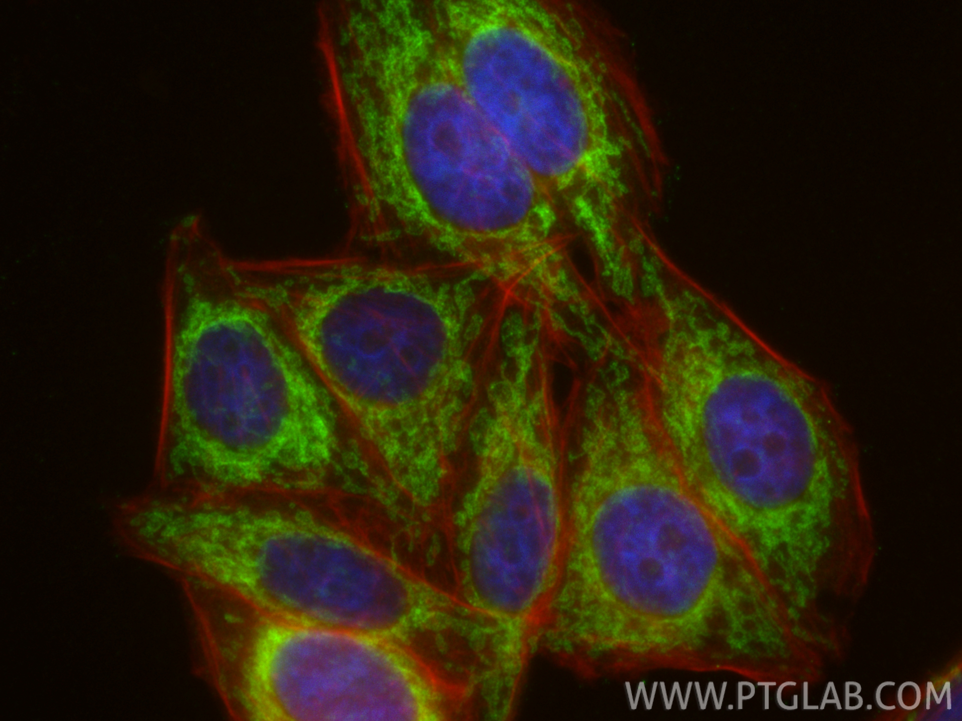 IF Staining of HepG2 using 11802-1-AP IF Staining of HepG2 using 11802-1-AP