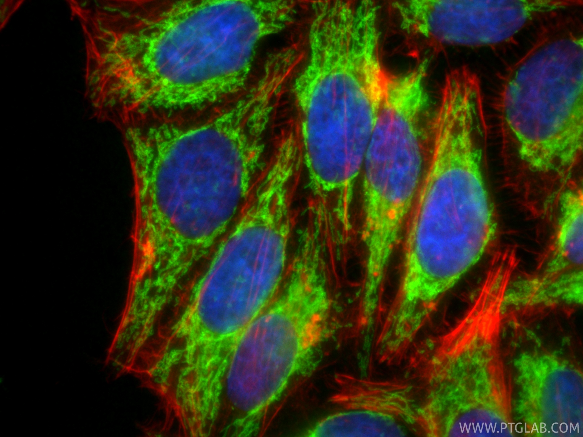 IF Staining of HepG2 using 11802-1-AP IF Staining of HepG2 using 11802-1-AP