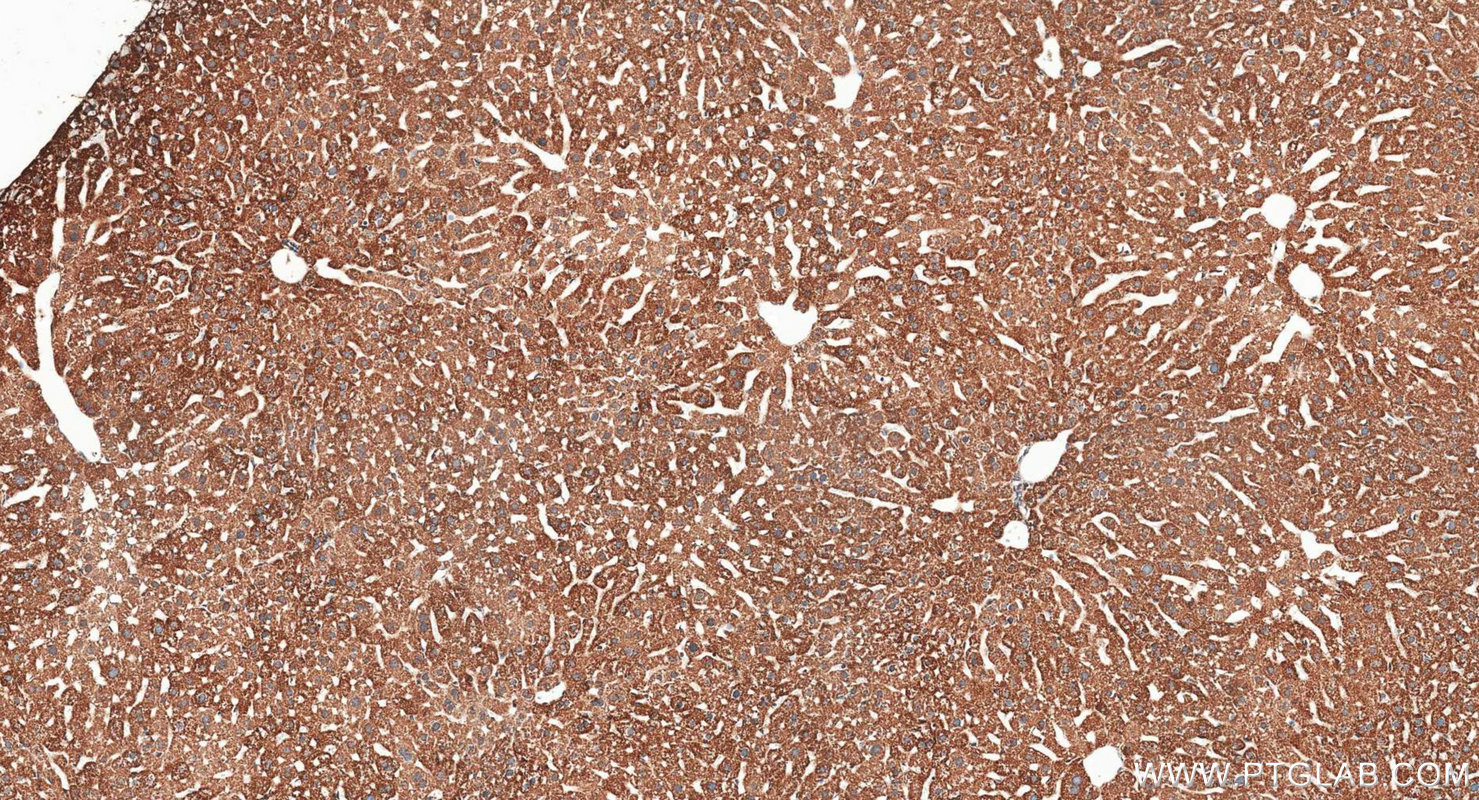 IHC staining of mouse liver using 11802-1-AP