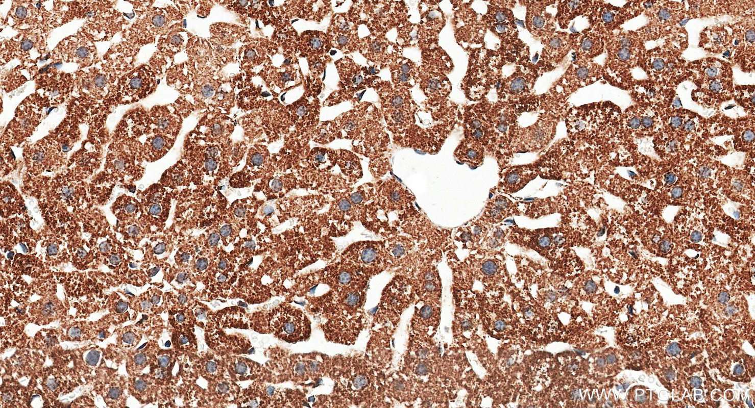 IHC staining of mouse liver using 11802-1-AP
