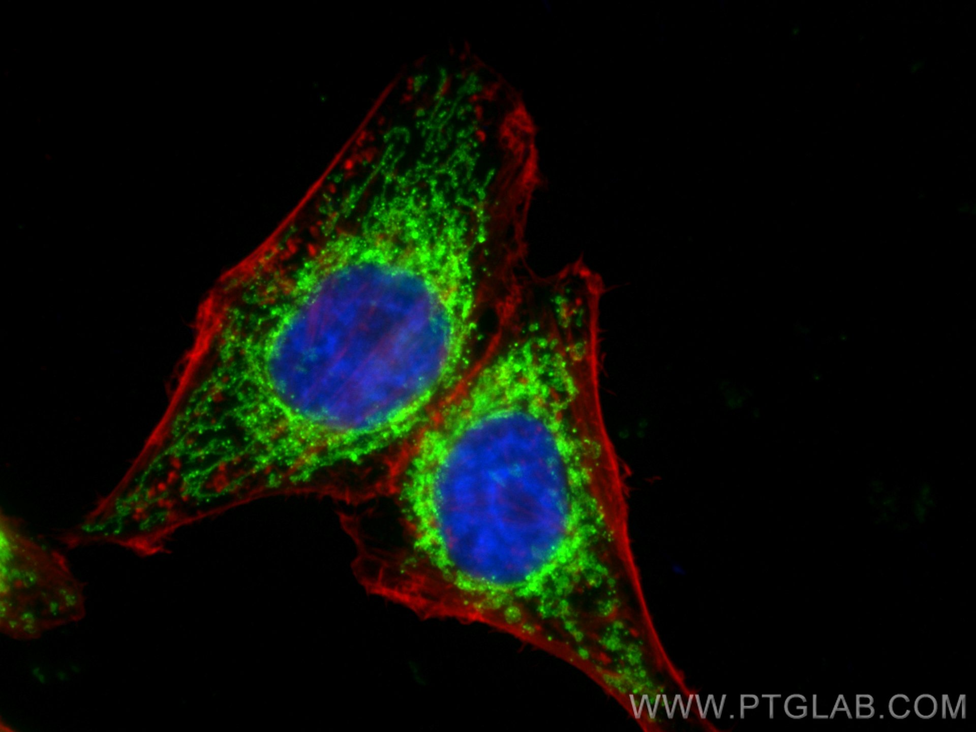 IF Staining of HepG2 using 80501-1-RR (same clone as 80501-1-PBS)