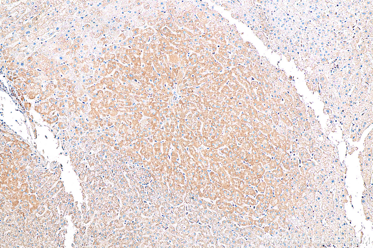 IHC staining of human liver using 80501-1-RR (same clone as 80501-1-PBS)