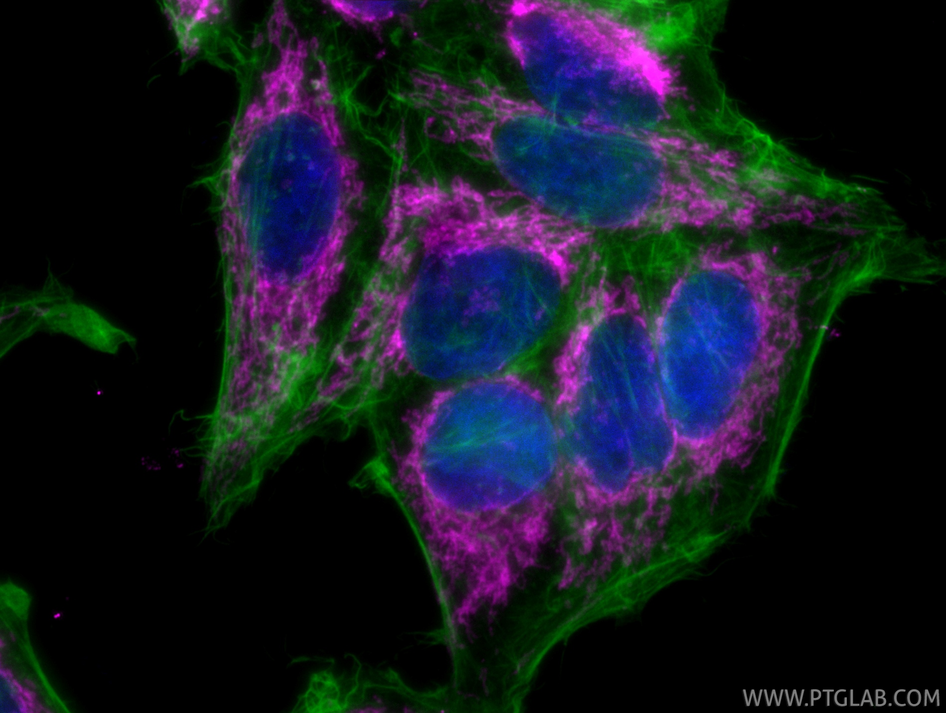 IF Staining of HepG2 using CL647-80501 IF Staining of HepG2 using CL647-80501
