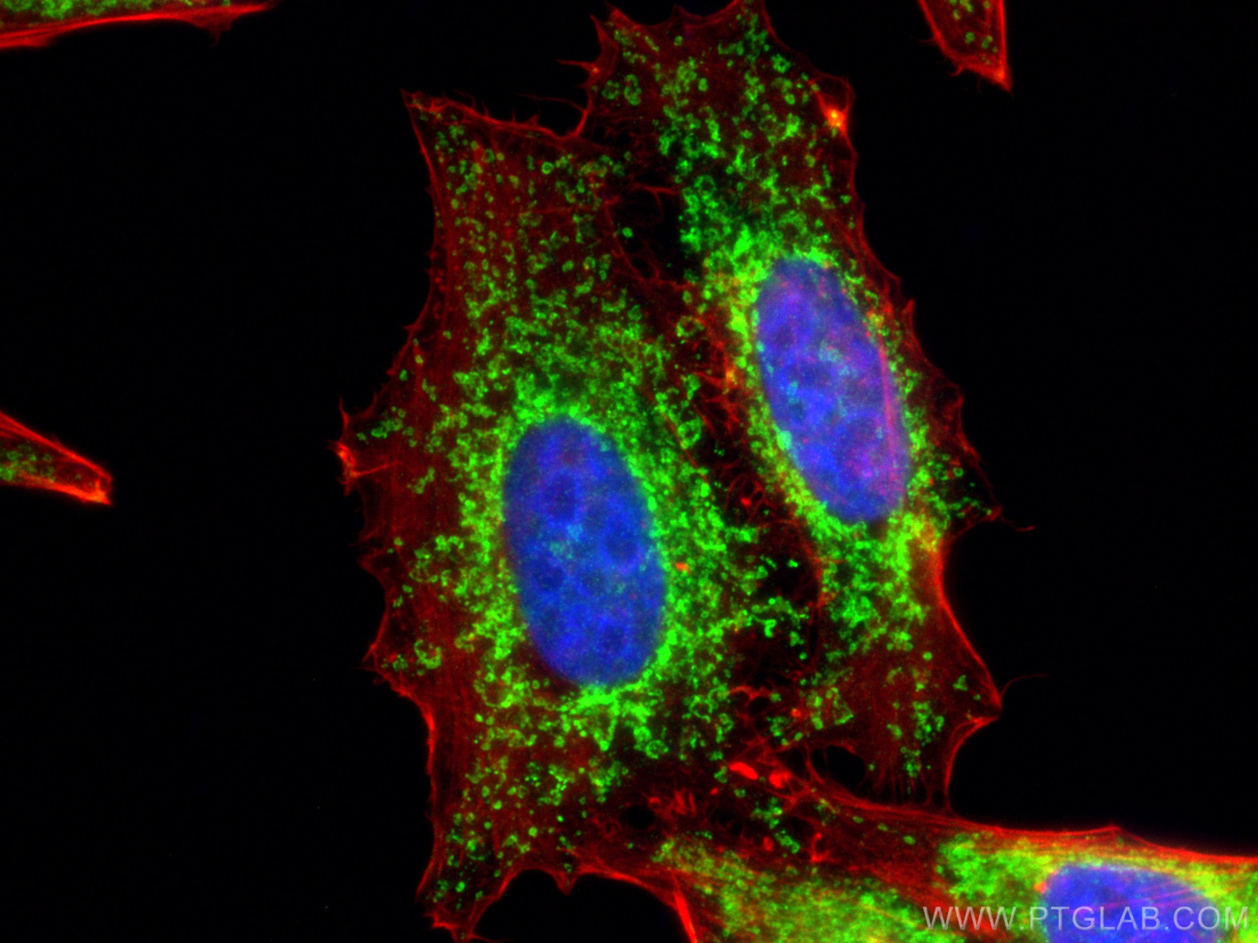 IF Staining of HepG2 using 14528-1-AP