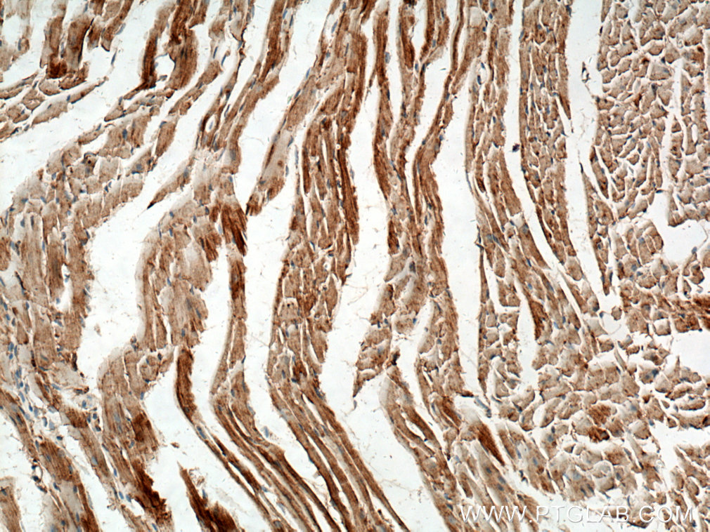 IHC staining of mouse heart using 14528-1-AP