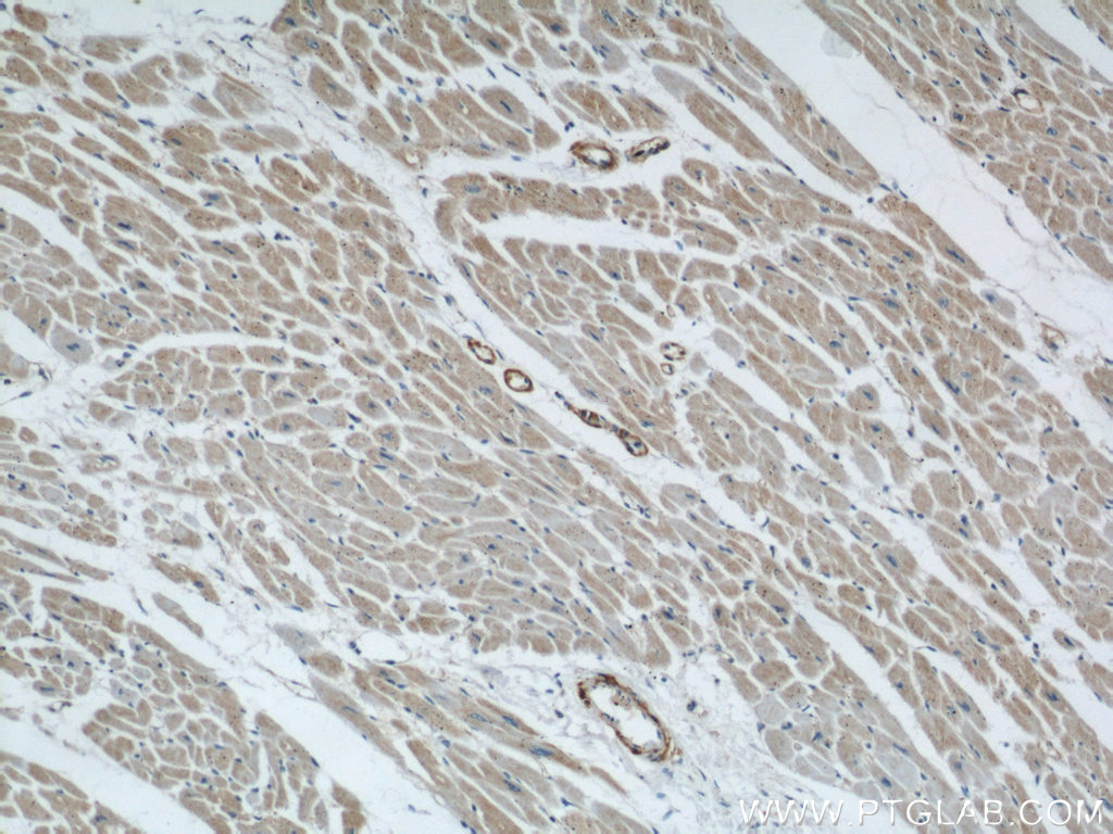 IHC staining of human heart using 14528-1-AP