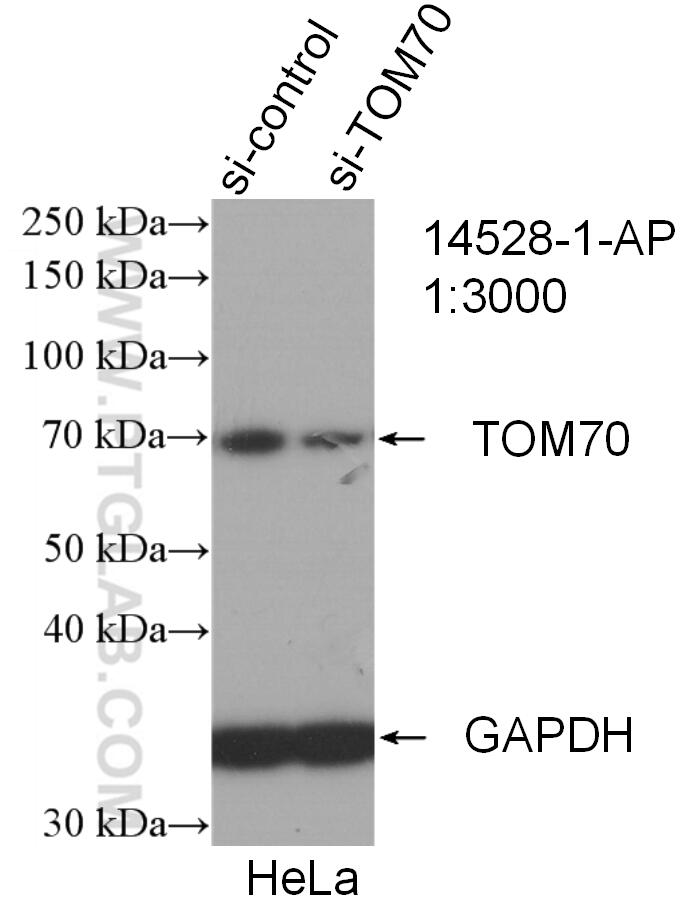 WB analysis of HeLa using 14528-1-AP