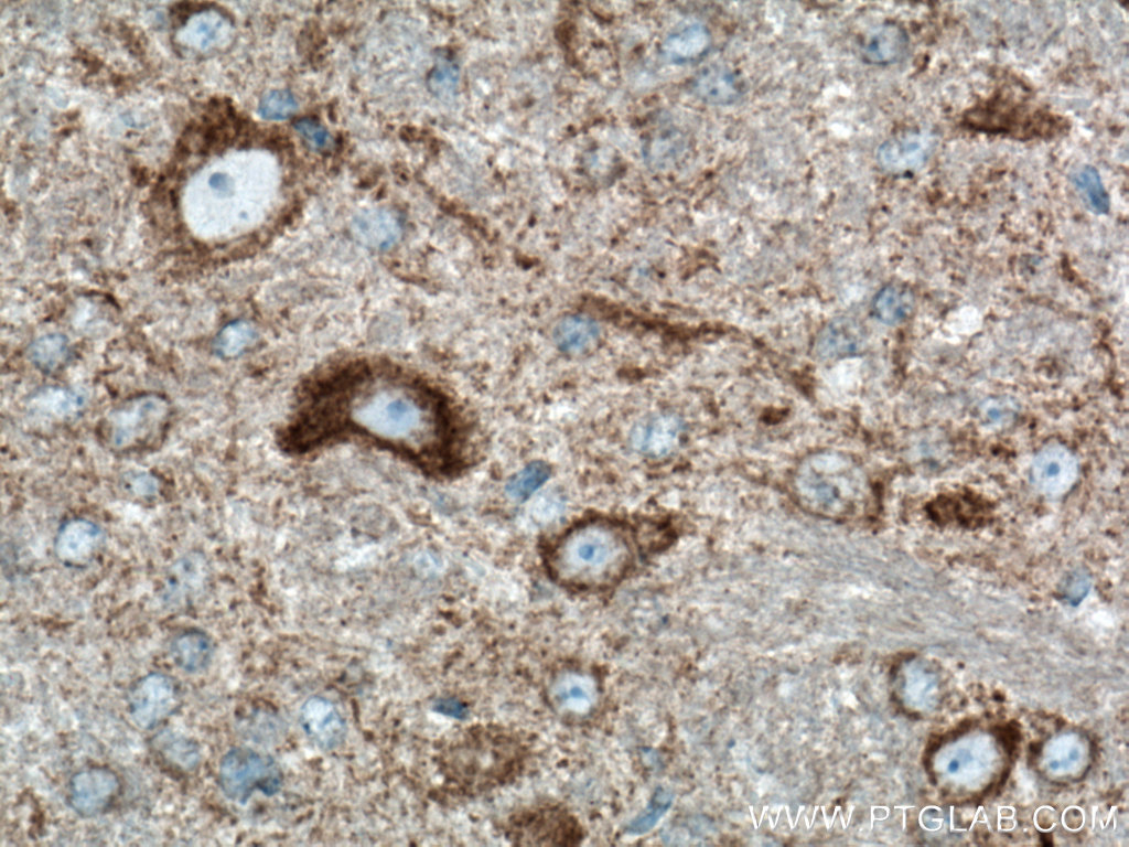 IHC staining of mouse brain using 66593-1-Ig