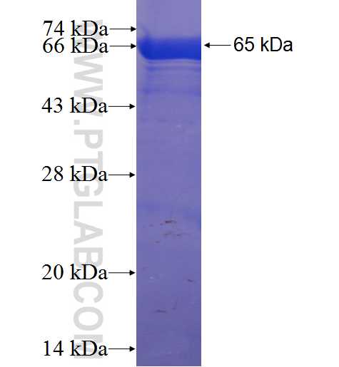 TOM70 fusion protein Ag6027 SDS-PAGE