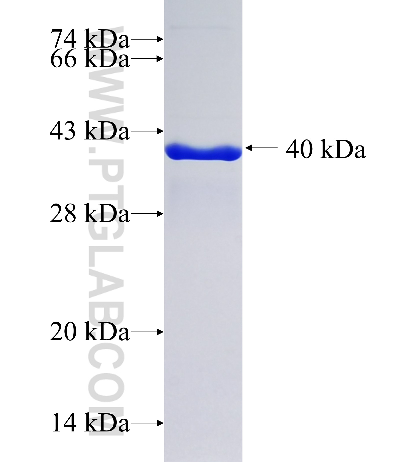 TOMM20L fusion protein Ag21972 SDS-PAGE TOMM20L fusion protein Ag21972 SDS-PAGE