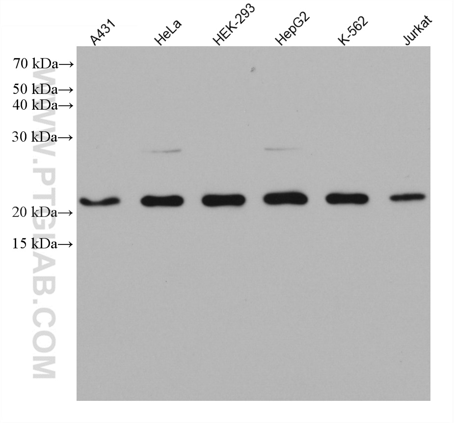 WB analysis using 66562-1-Ig