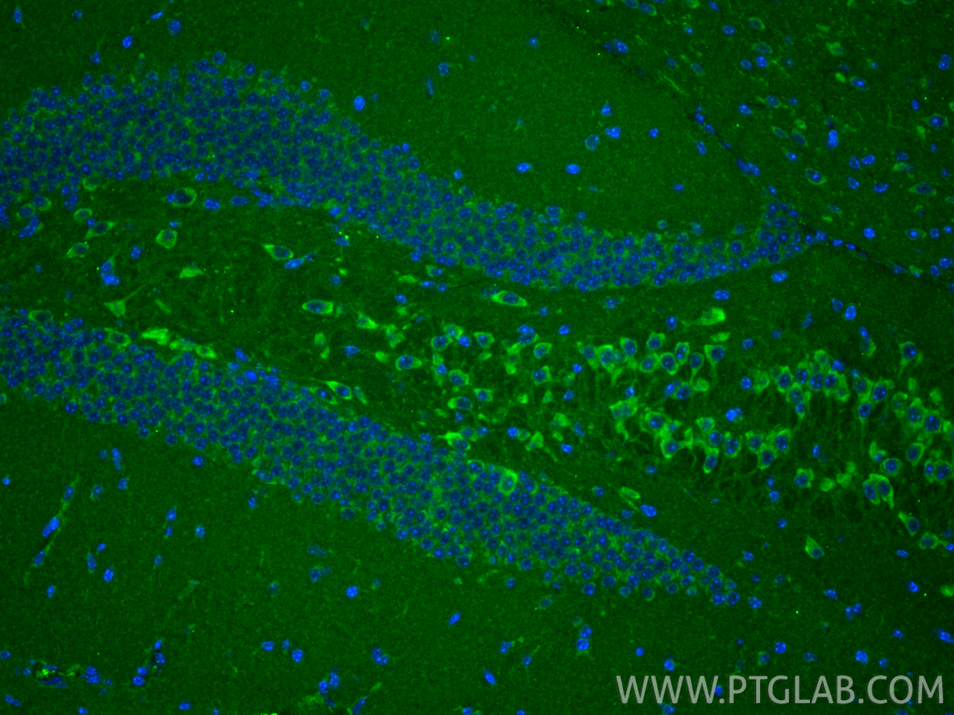 IF Staining of mouse brain using 12196-1-AP