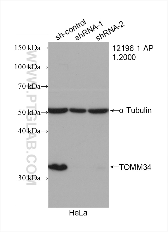 WB analysis of HeLa using 12196-1-AP