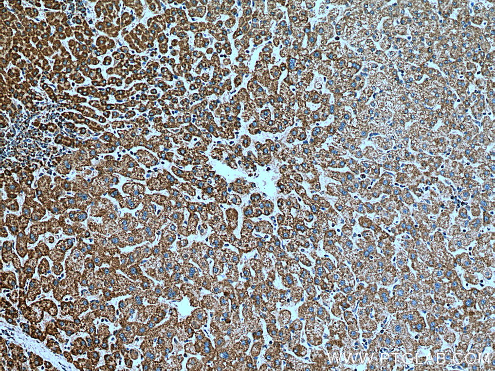IHC staining of human liver using 18409-1-AP