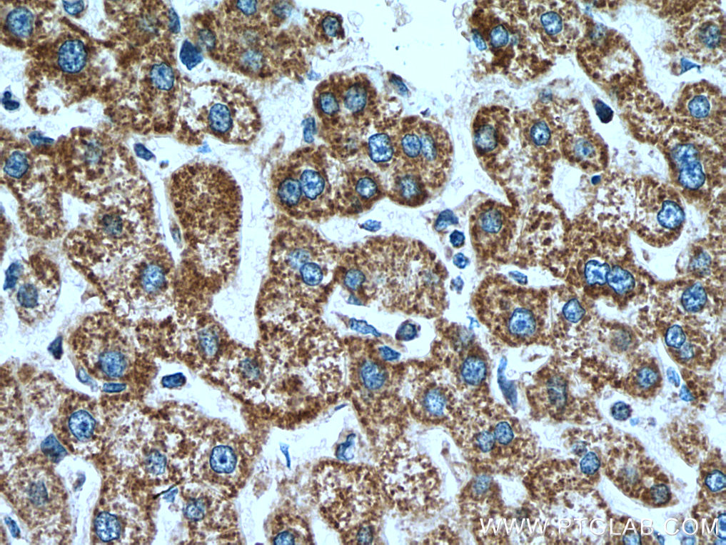 IHC staining of human liver using 18409-1-AP