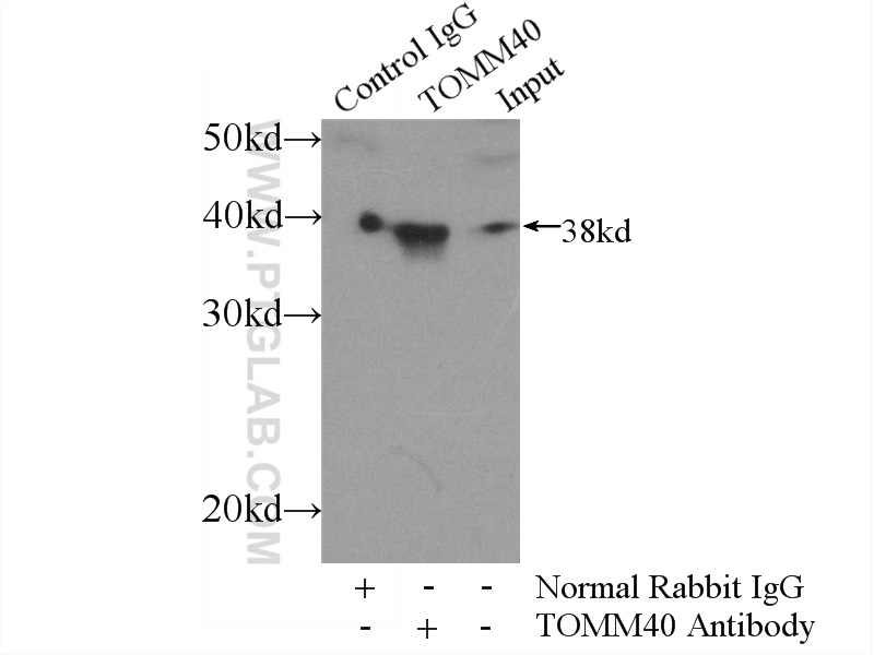 IP experiment of mouse liver using 18409-1-AP