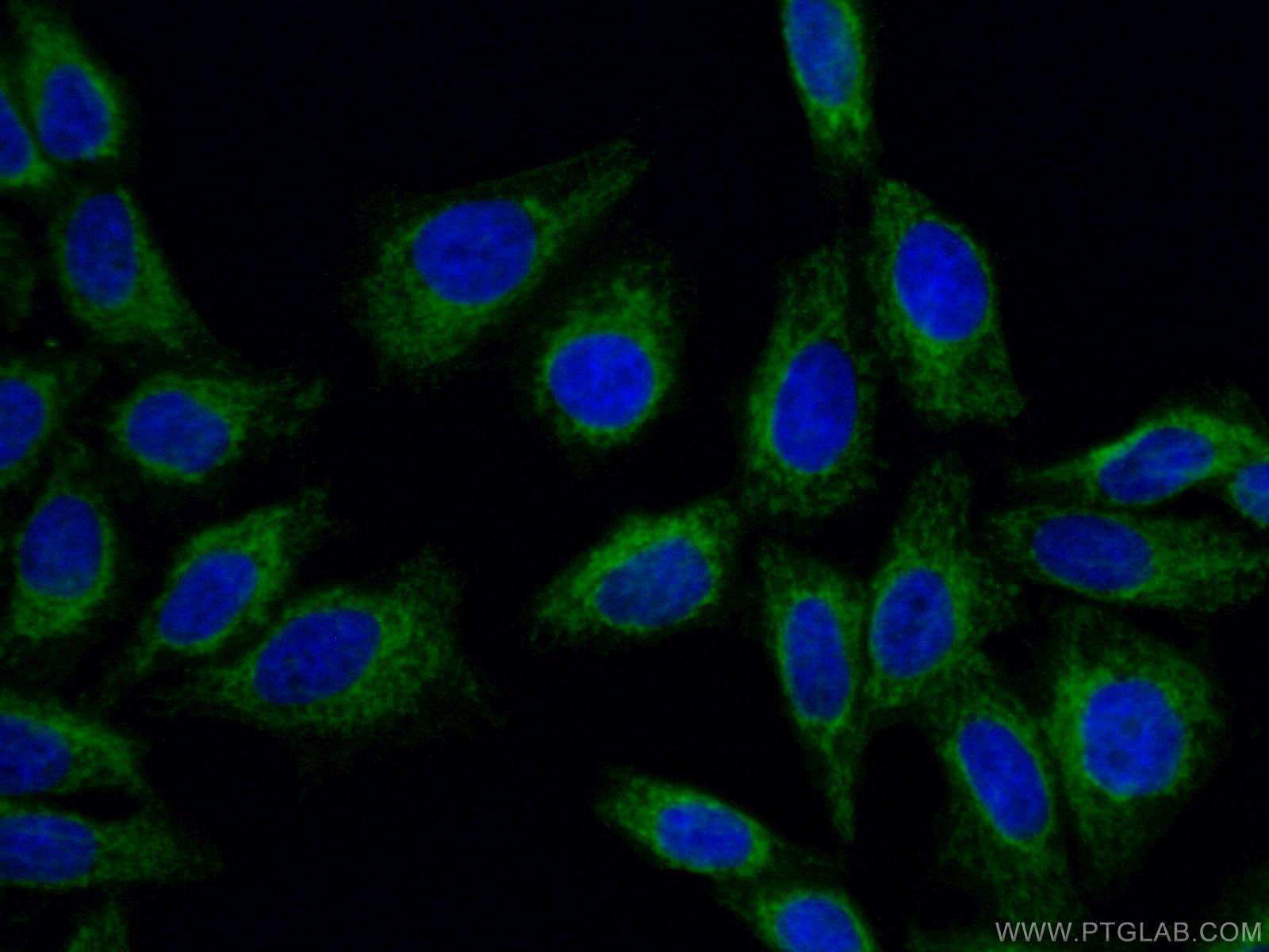 IF Staining of HepG2 using 66658-1-Ig (same clone as 66658-1-PBS)