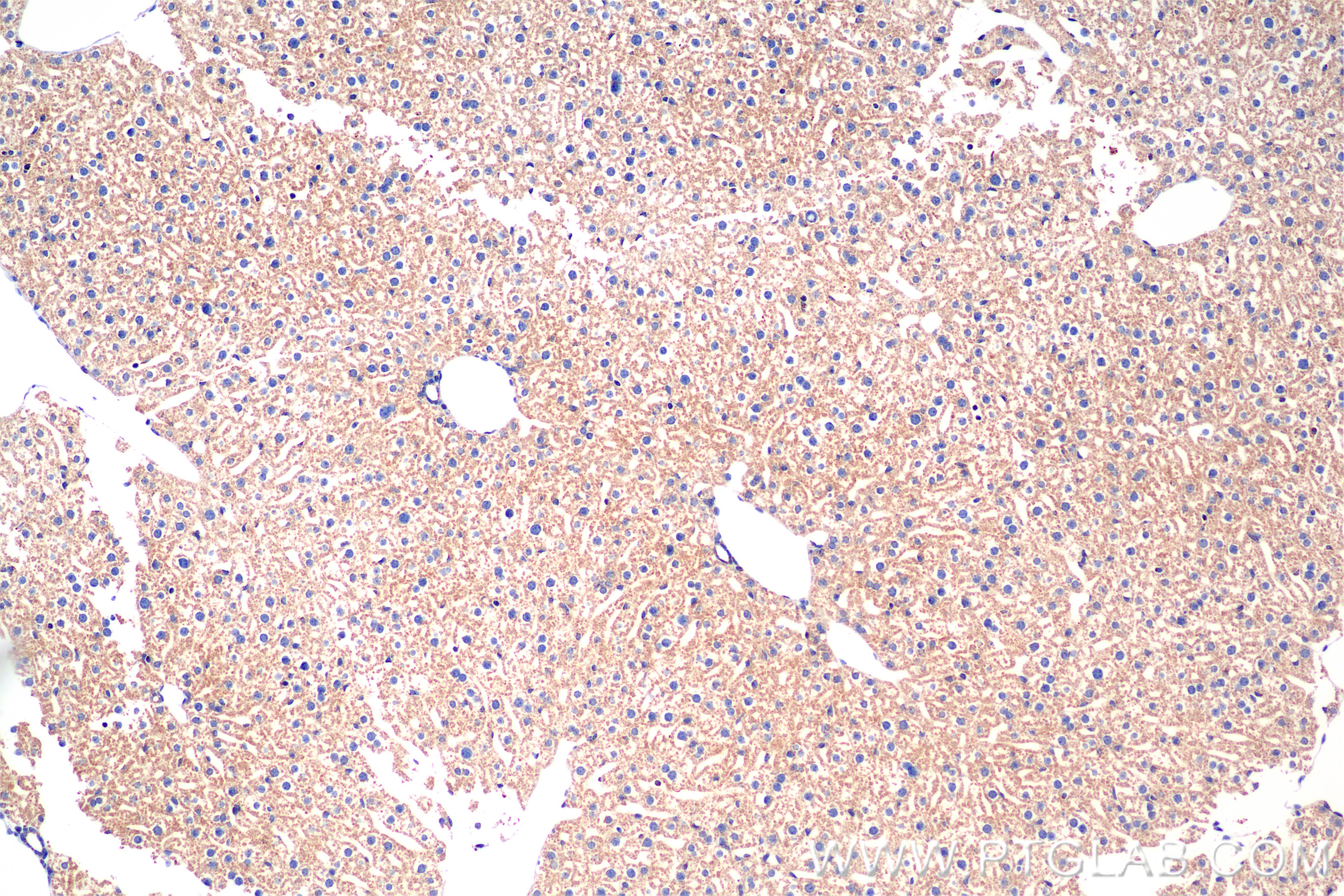 IHC staining of mouse liver using 85773-4-RR