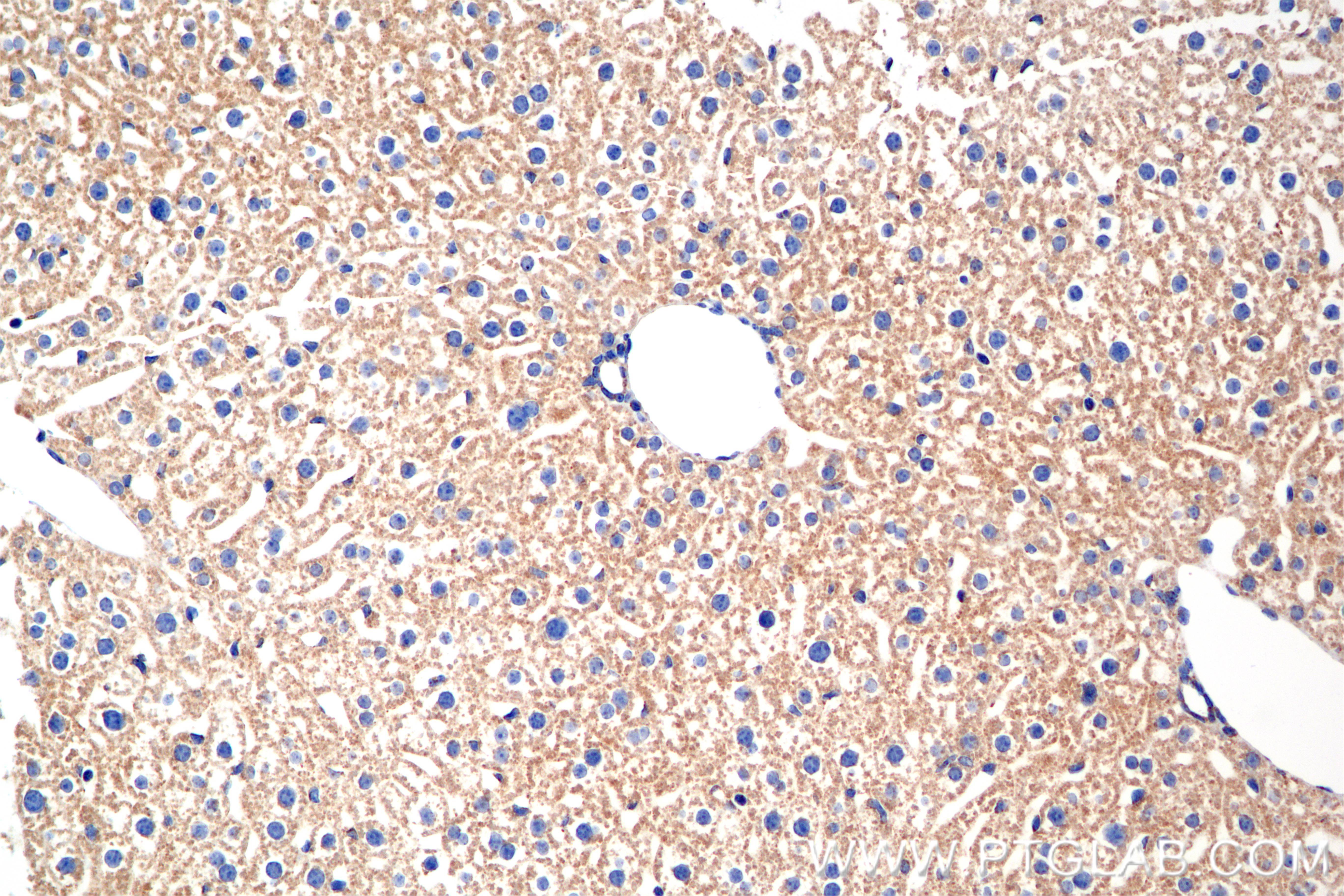 IHC staining of mouse liver using 85773-4-RR