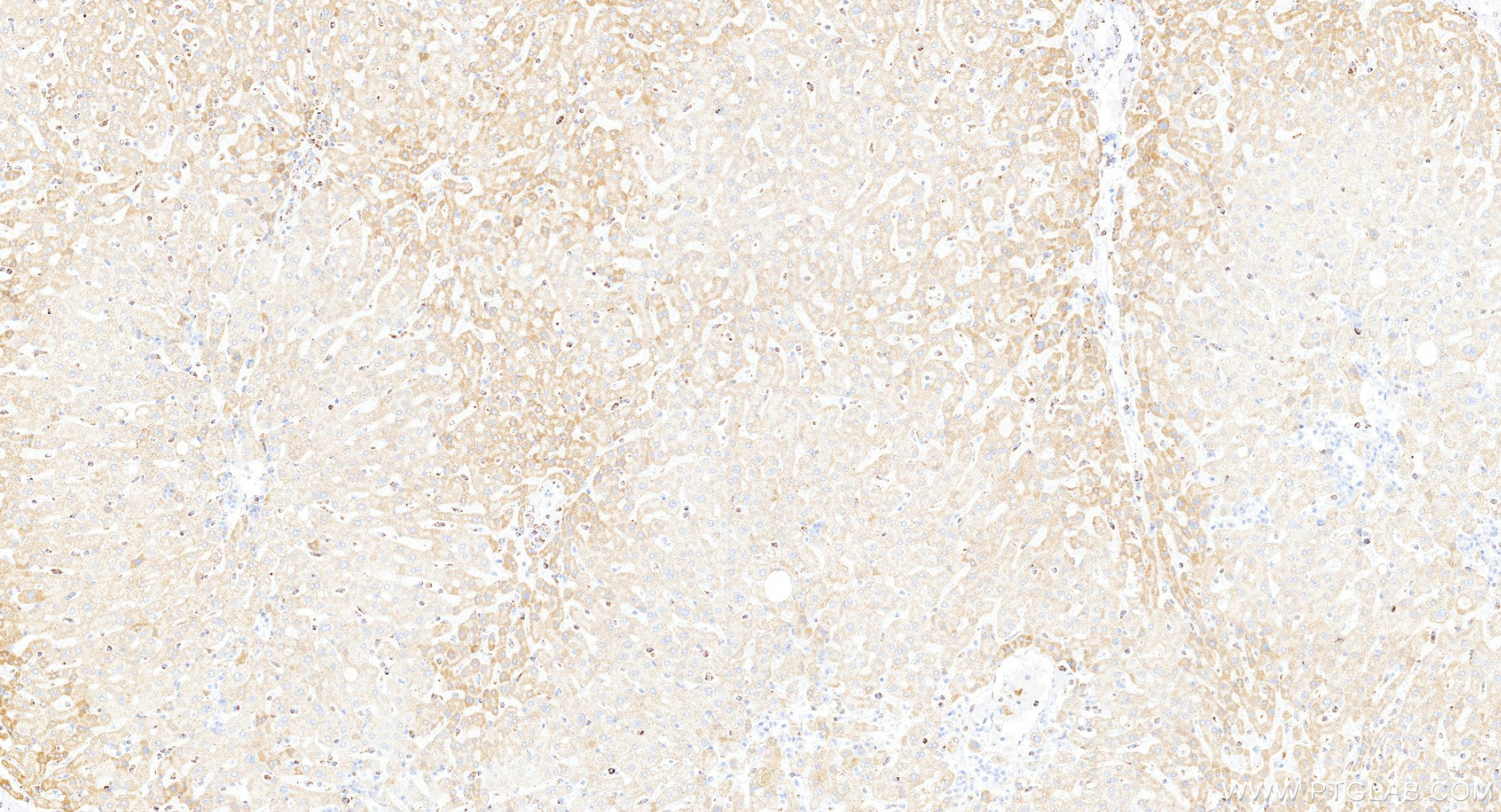 IHC staining of human liver using 85773-4-RR IHC staining of human liver using 85773-4-RR
