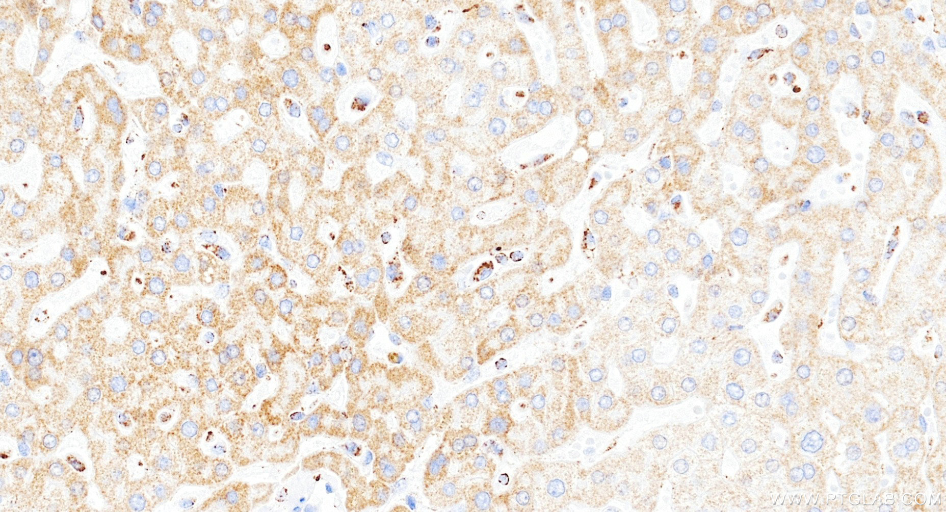 IHC staining of human liver using 85773-4-RR IHC staining of human liver using 85773-4-RR