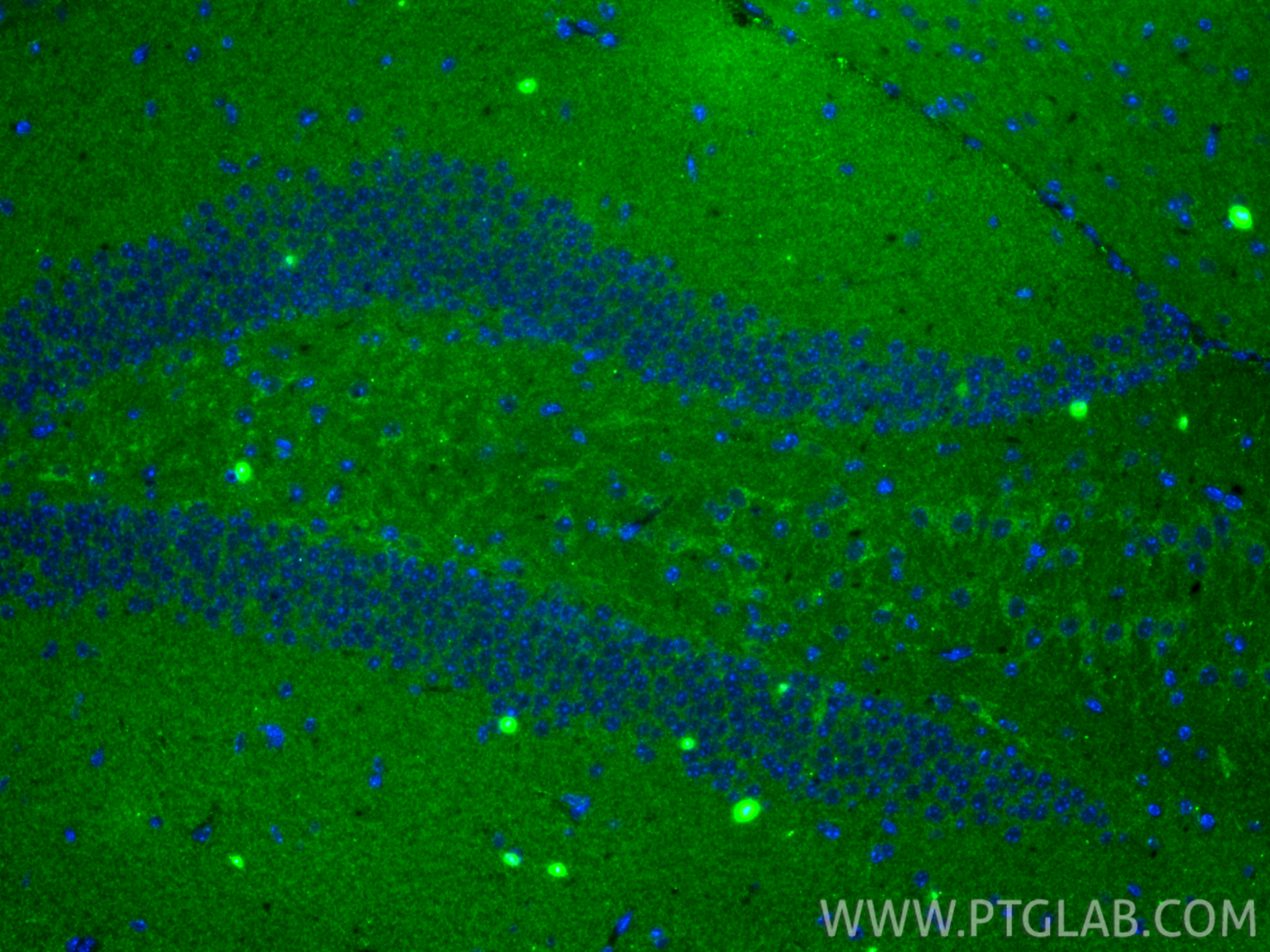 IF Staining of mouse brain using 86943-1-RR