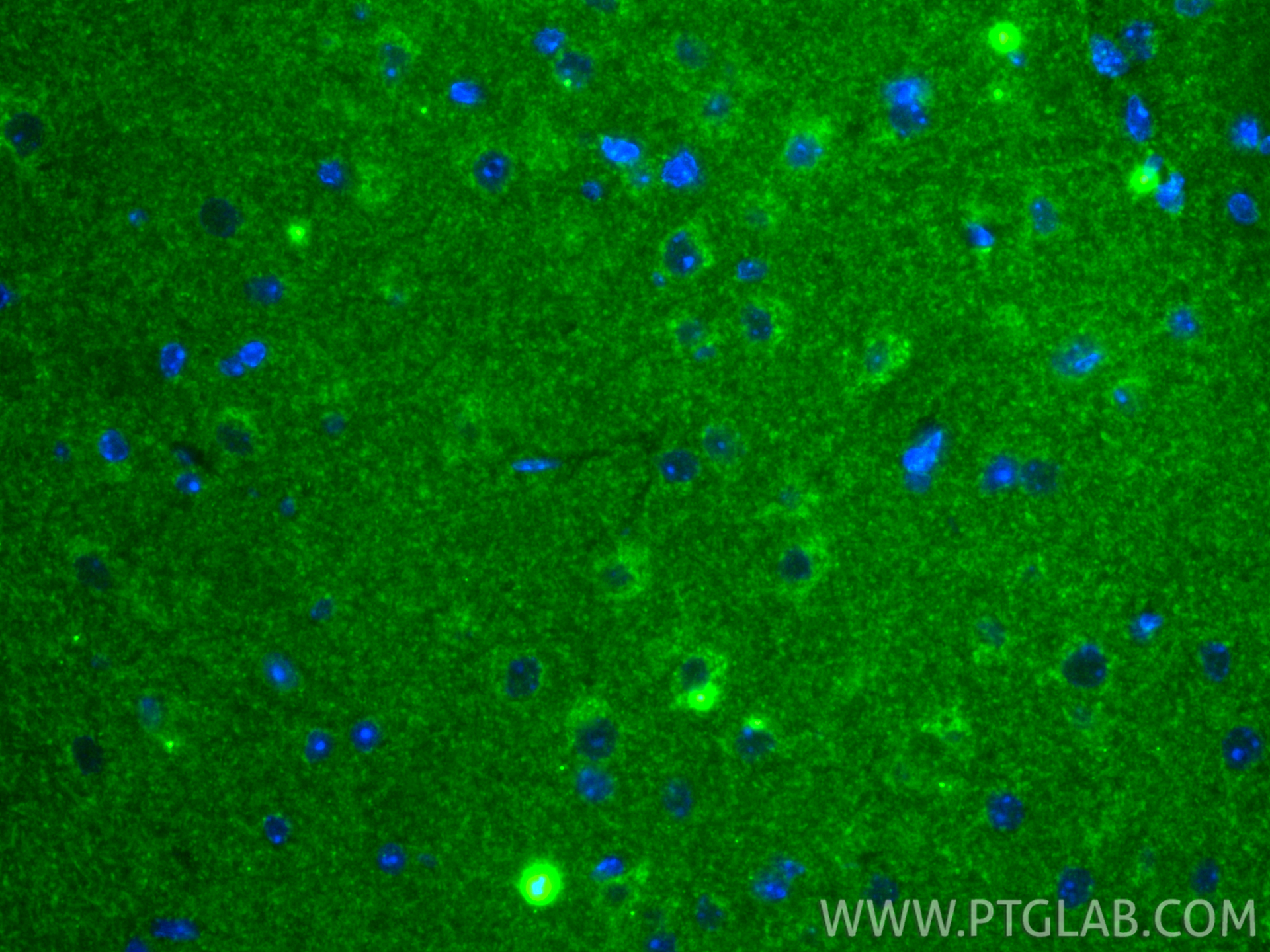 IF Staining of mouse brain using 86943-1-RR