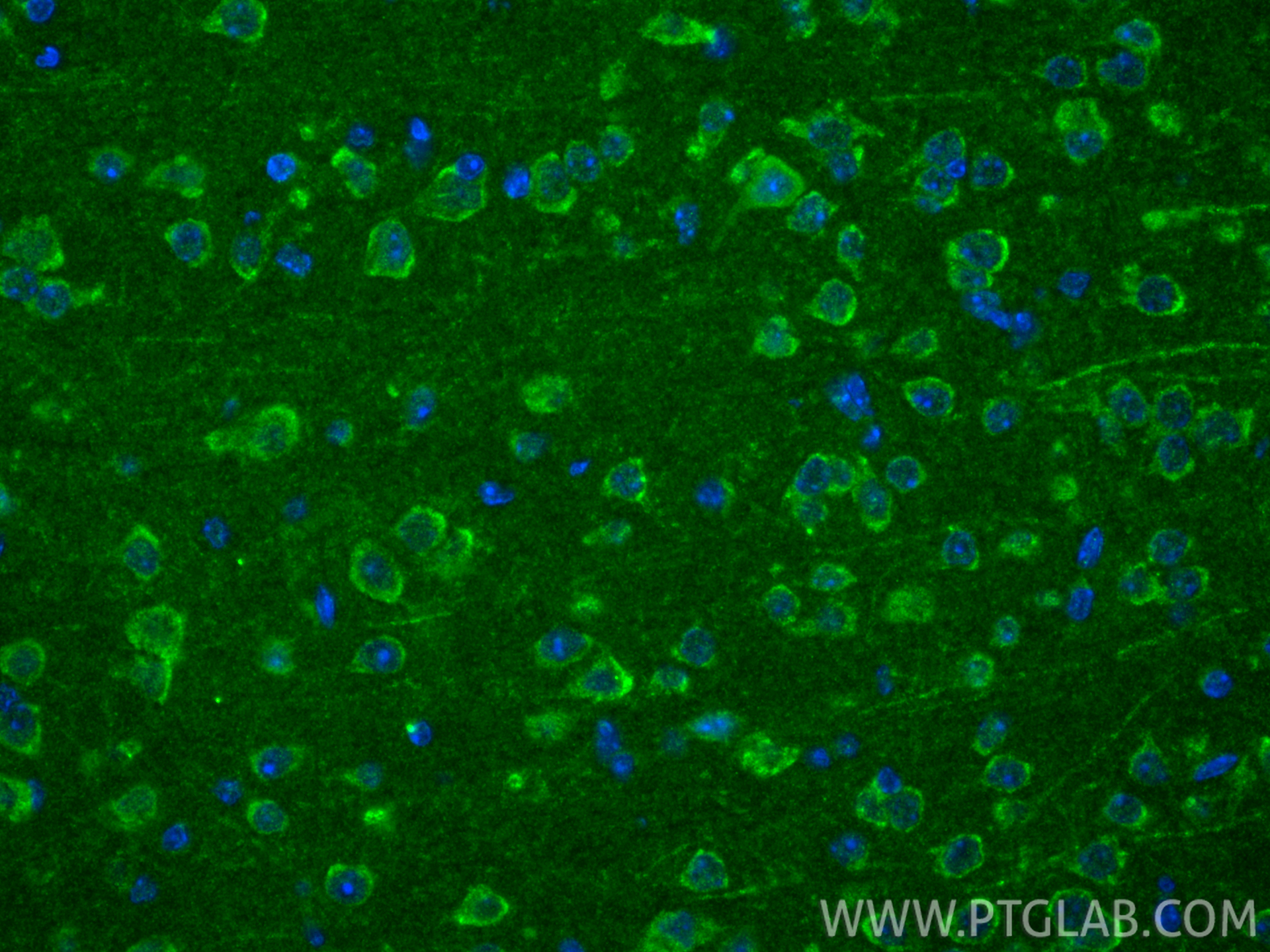 IF Staining of mouse brain using 16689-1-AP IF Staining of mouse brain using 16689-1-AP