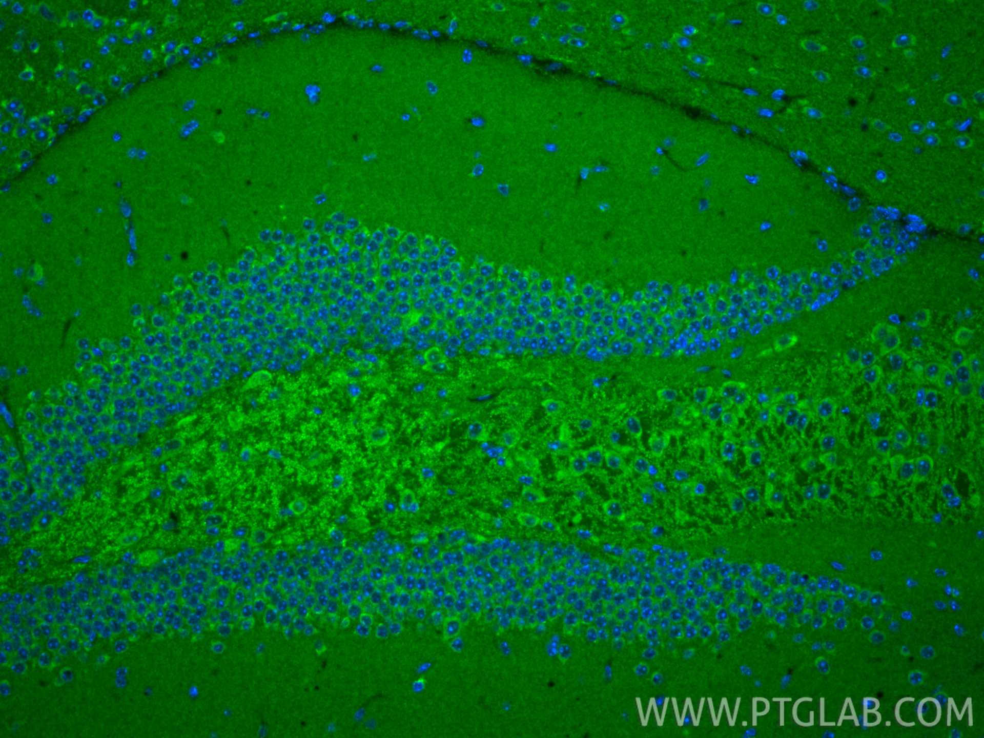 IF Staining of mouse brain using 16540-1-AP