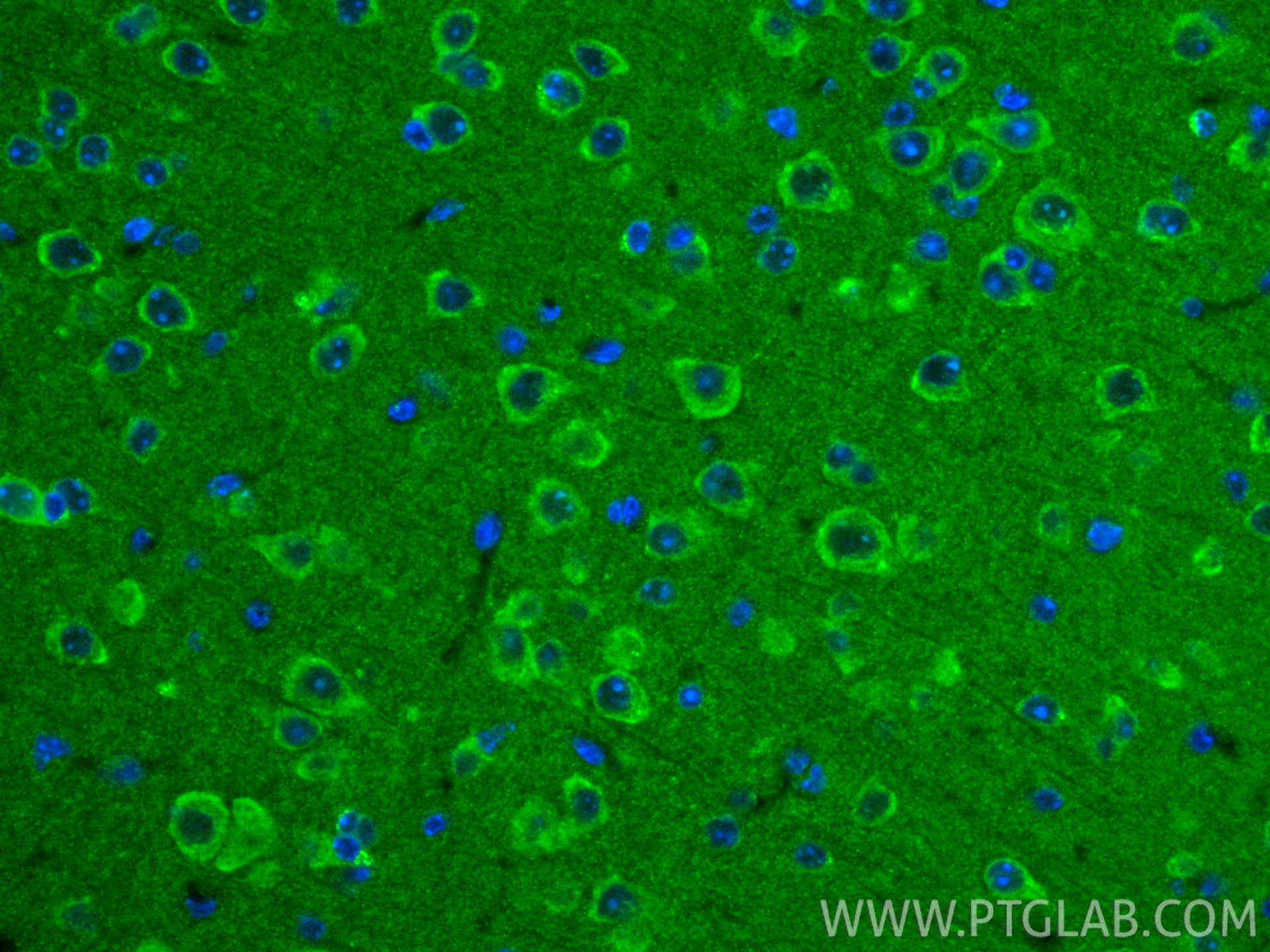 IF Staining of mouse brain using 16540-1-AP
