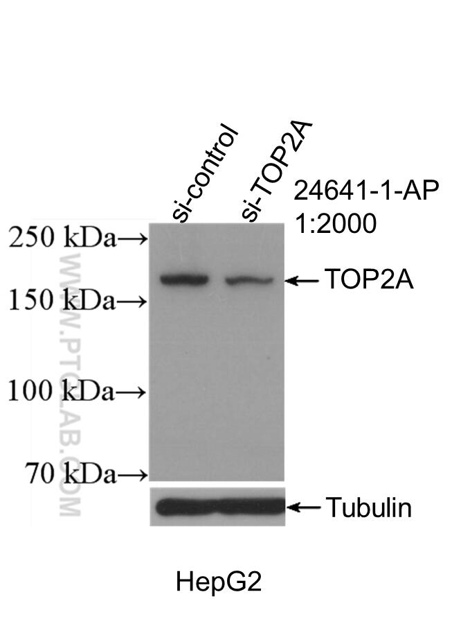 WB analysis of HepG2 using 24641-1-AP