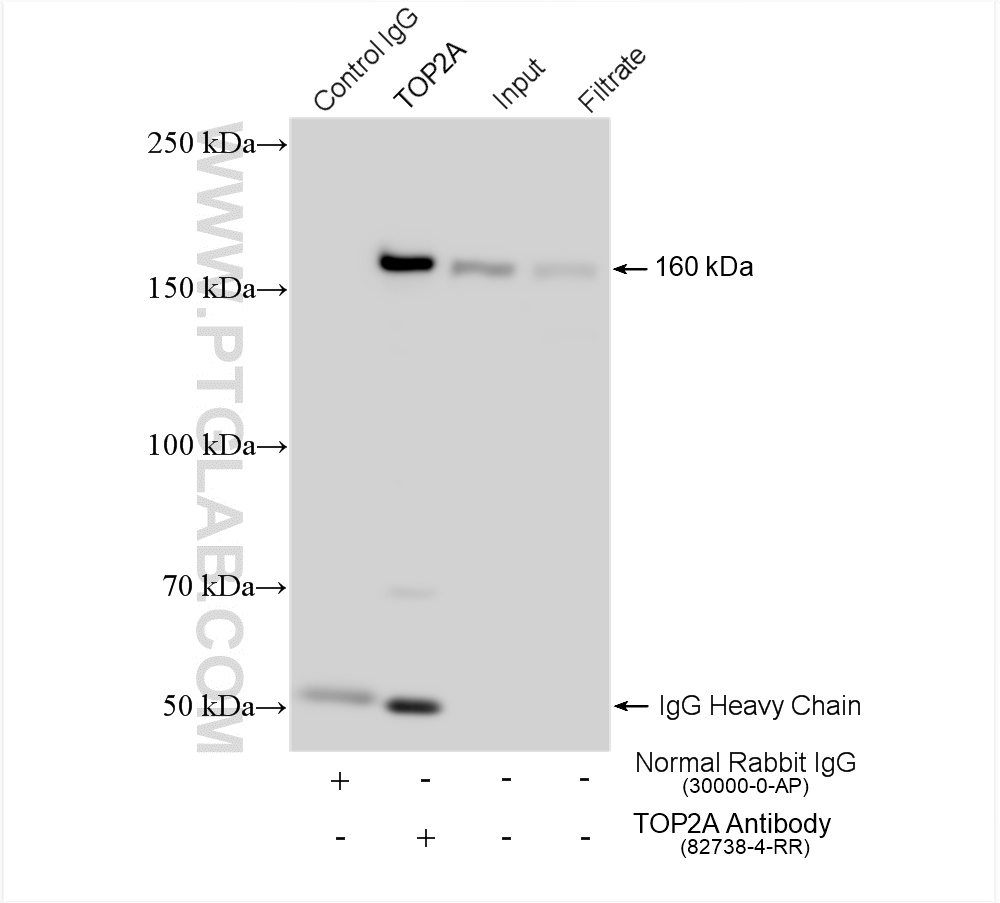 IP experiment of HeLa using 82738-4-RR