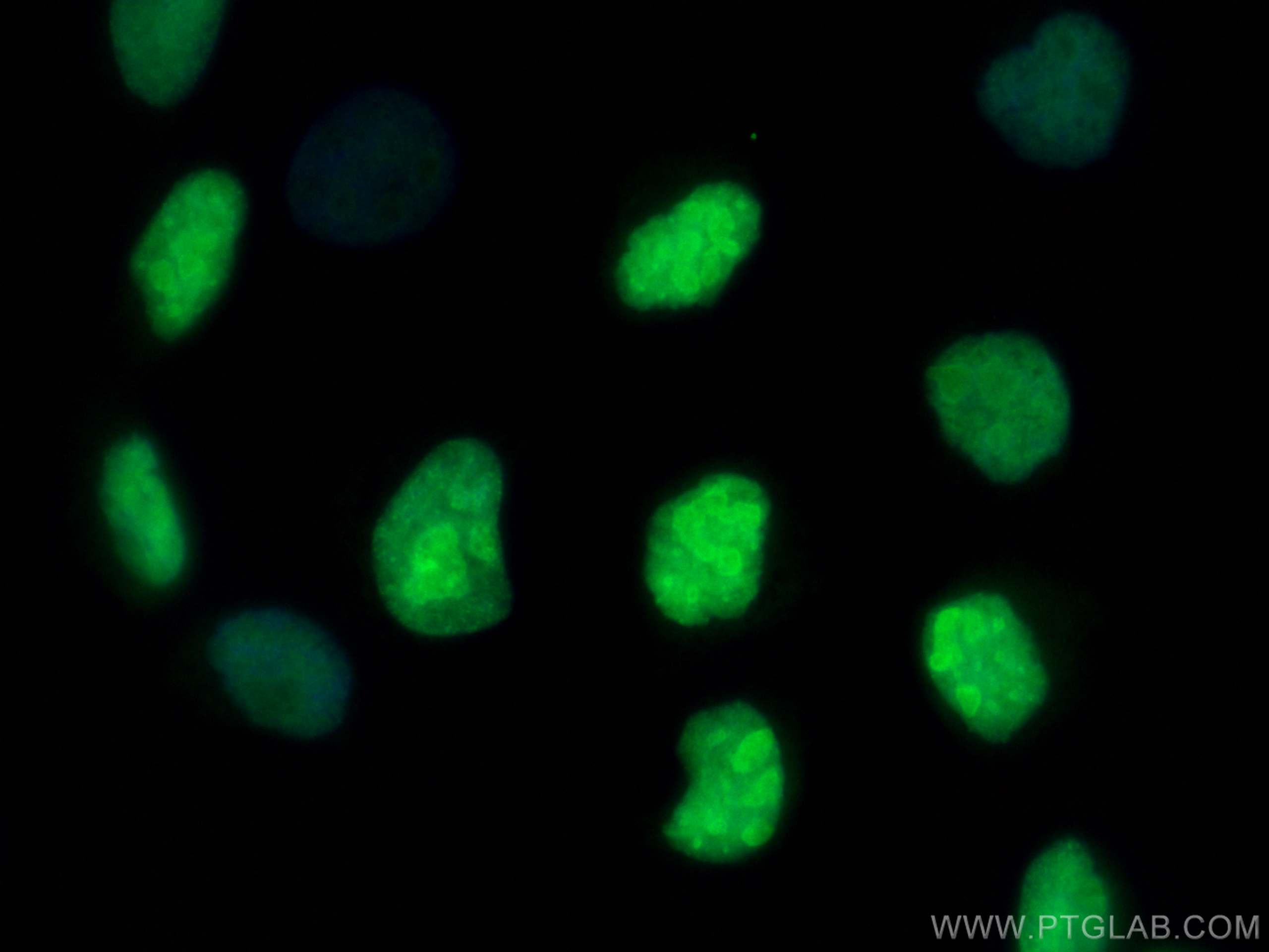 IF Staining of A431 using CL488-24641