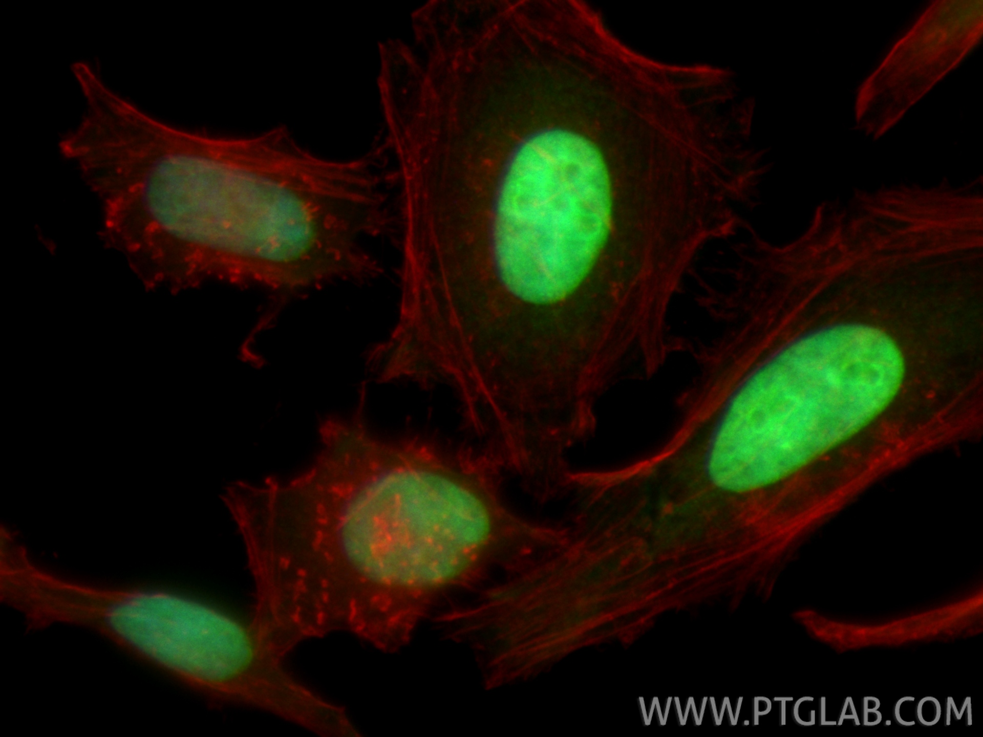 Immunofluorescent analysis of (4% PFA) fixed HeLa cells using CoraLite® Plus 488 TOP2A antibody (CL488-24641) at dilution of 1:200, CL594-phalloidin (red). IF Staining of HeLa using CL488-24641