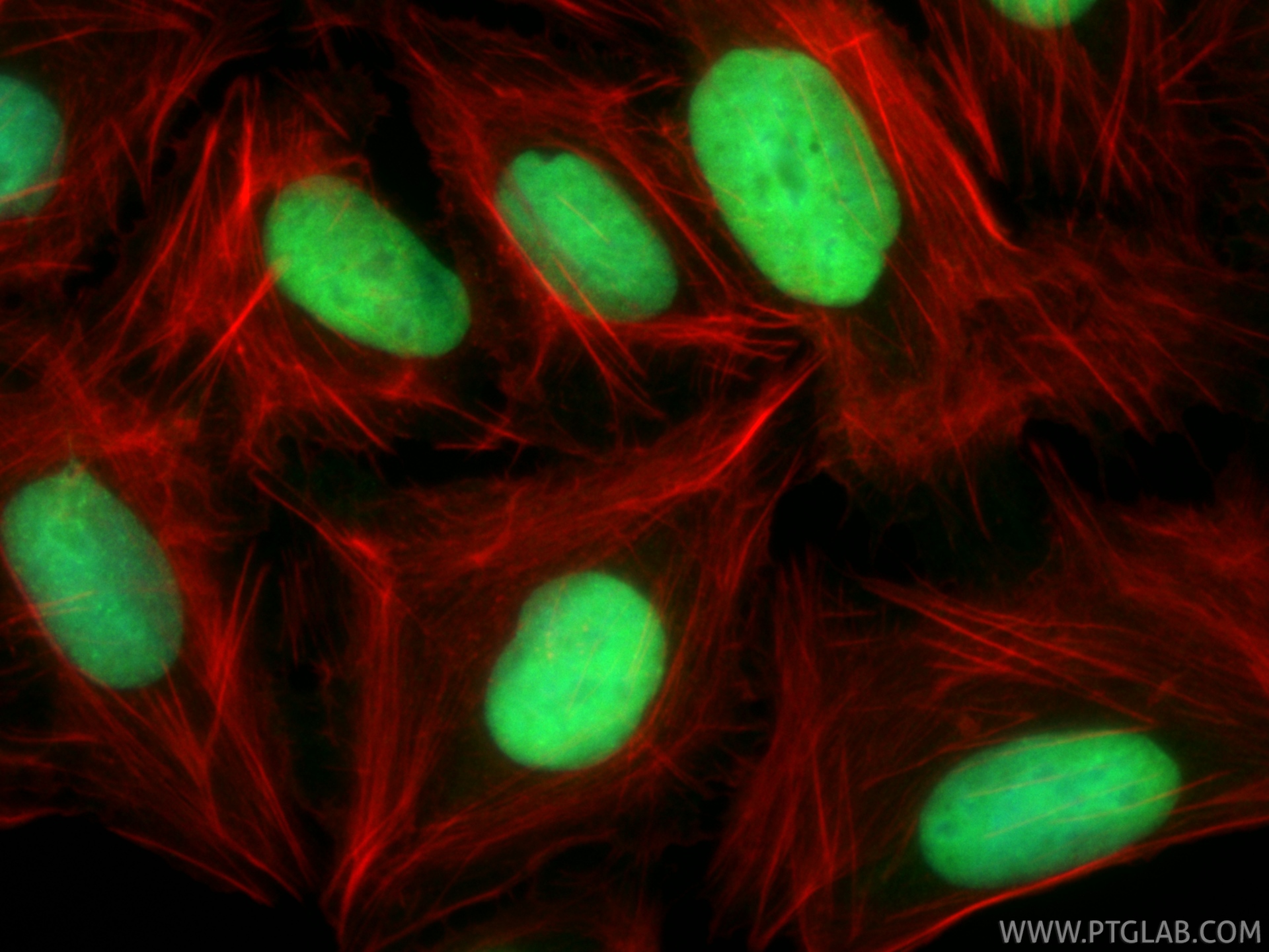 IF Staining of U2OS using 82738-10-RR IF Staining of U2OS using 82738-10-RR