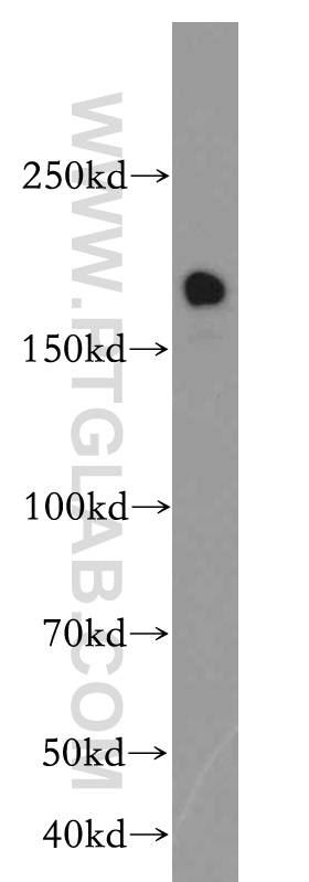 WB analysis of HeLa using 20549-1-AP