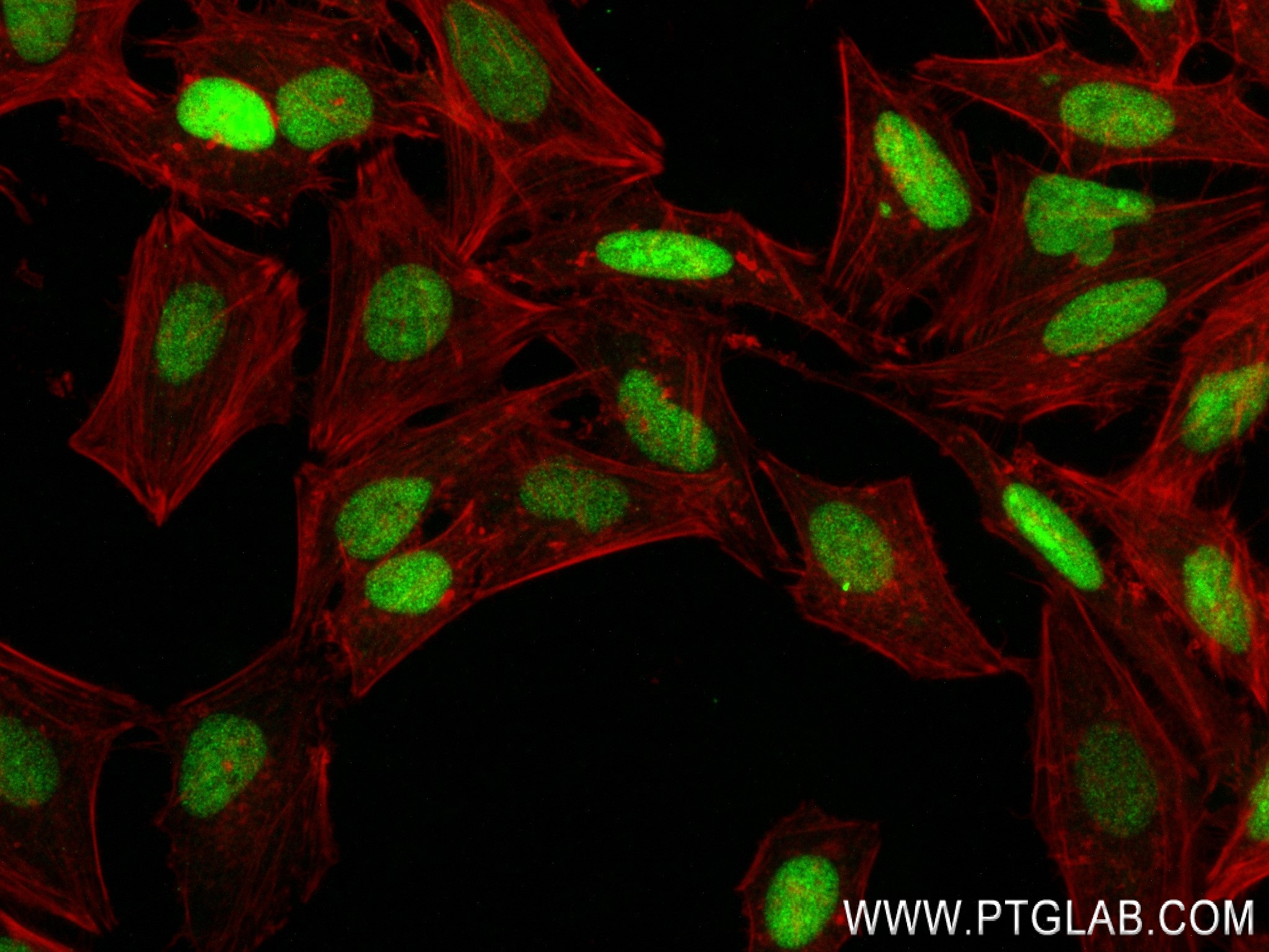IF Staining of HeLa using 84049-1-RR (same clone as 84049-1-PBS)