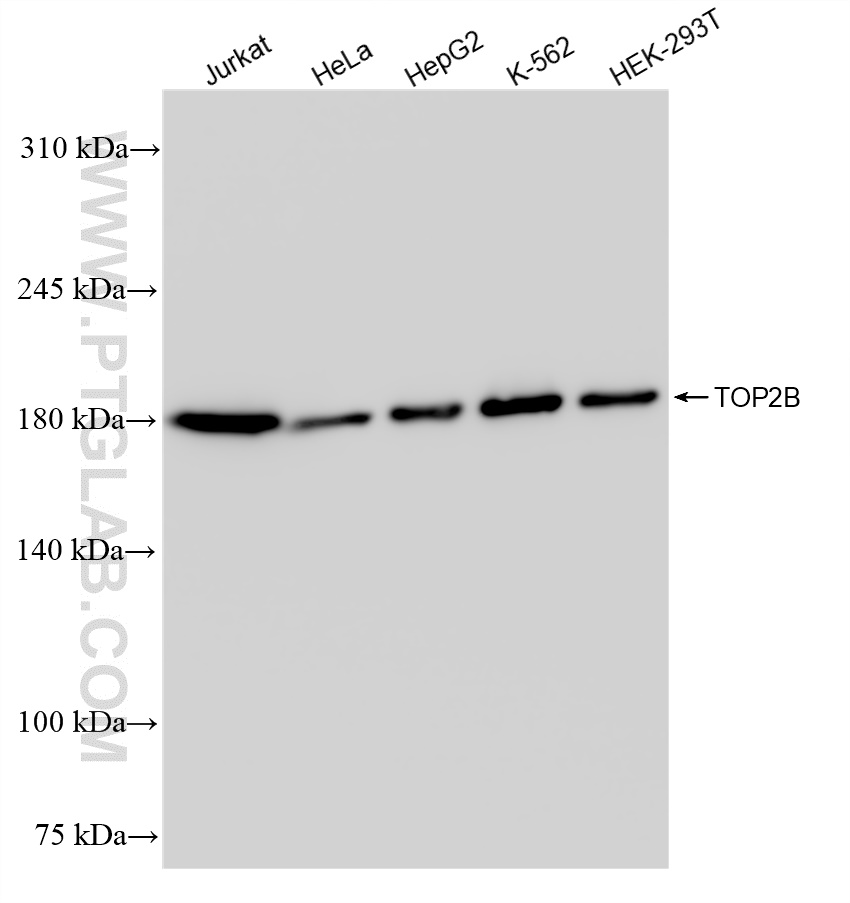 WB analysis using 84049-1-RR (same clone as 84049-1-PBS)