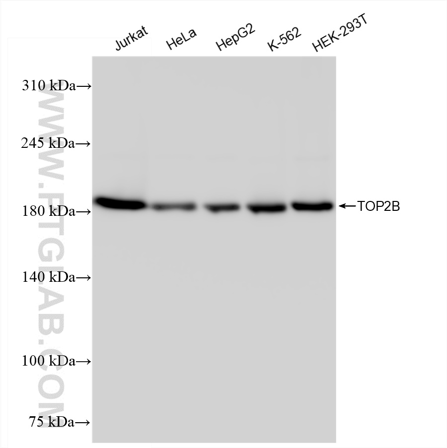 WB analysis using 84049-2-RR