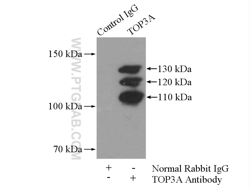 IP experiment of K-562 using 14525-1-AP